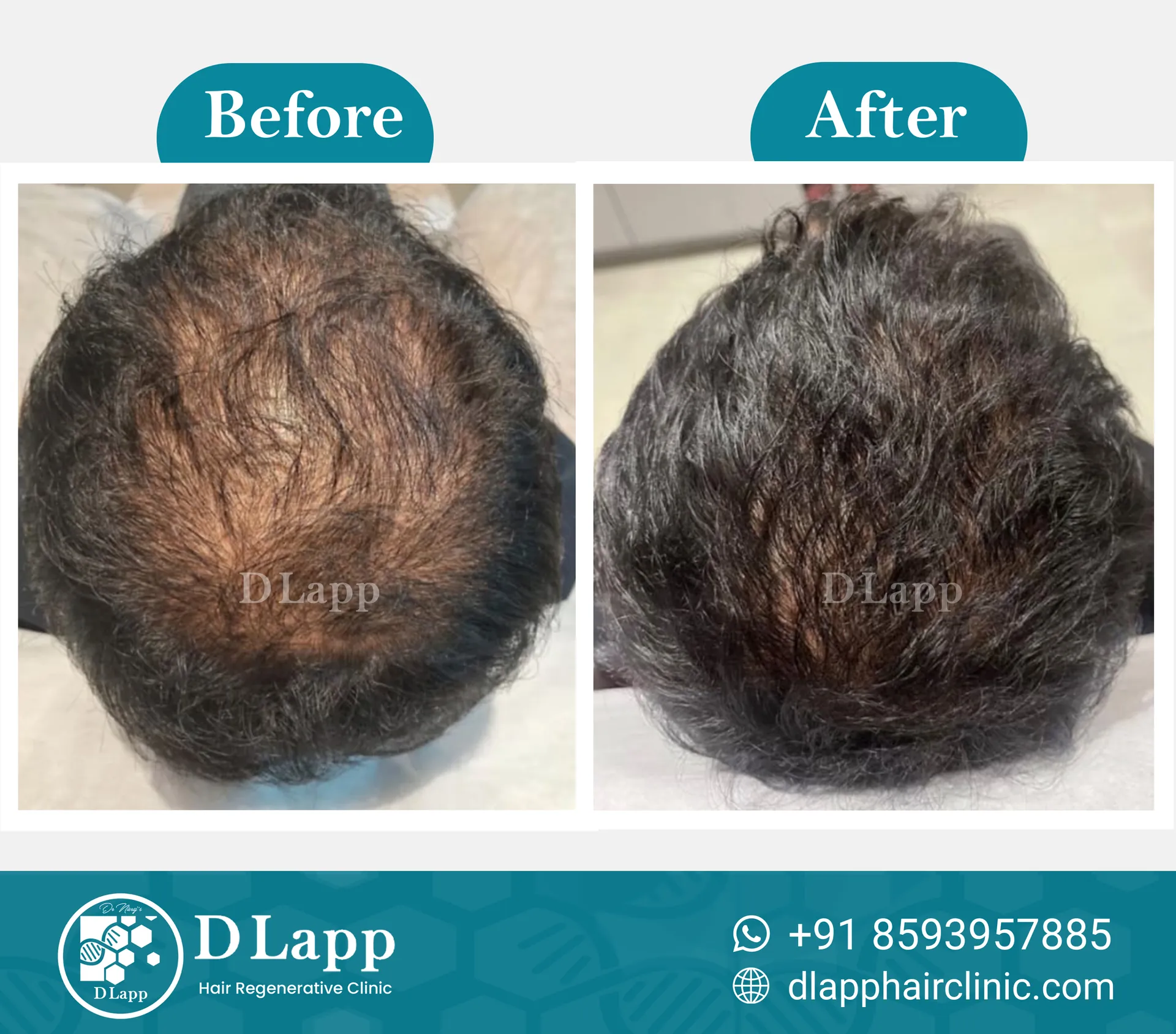 Before/After Medical Image