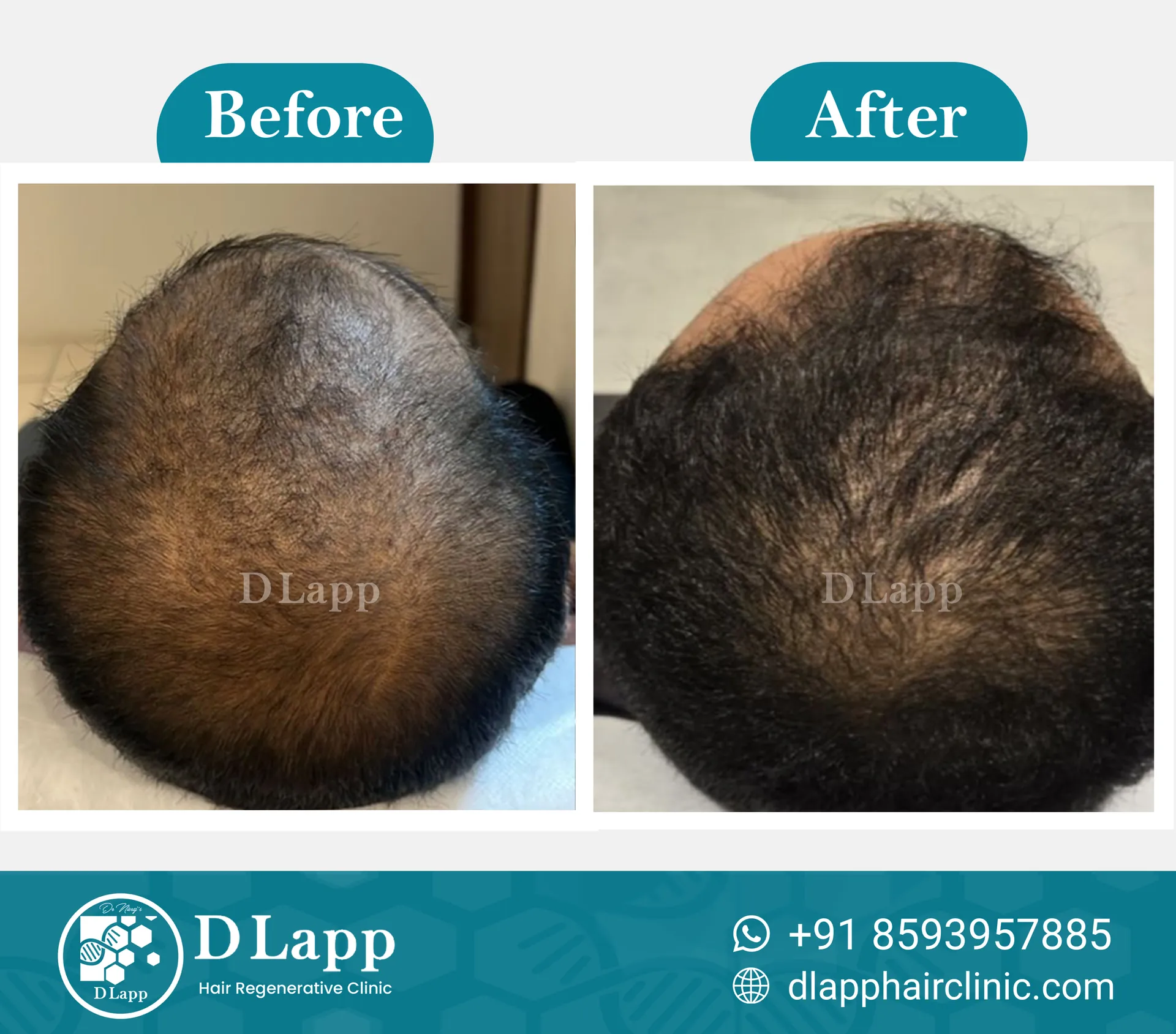 Before/After Medical Image
