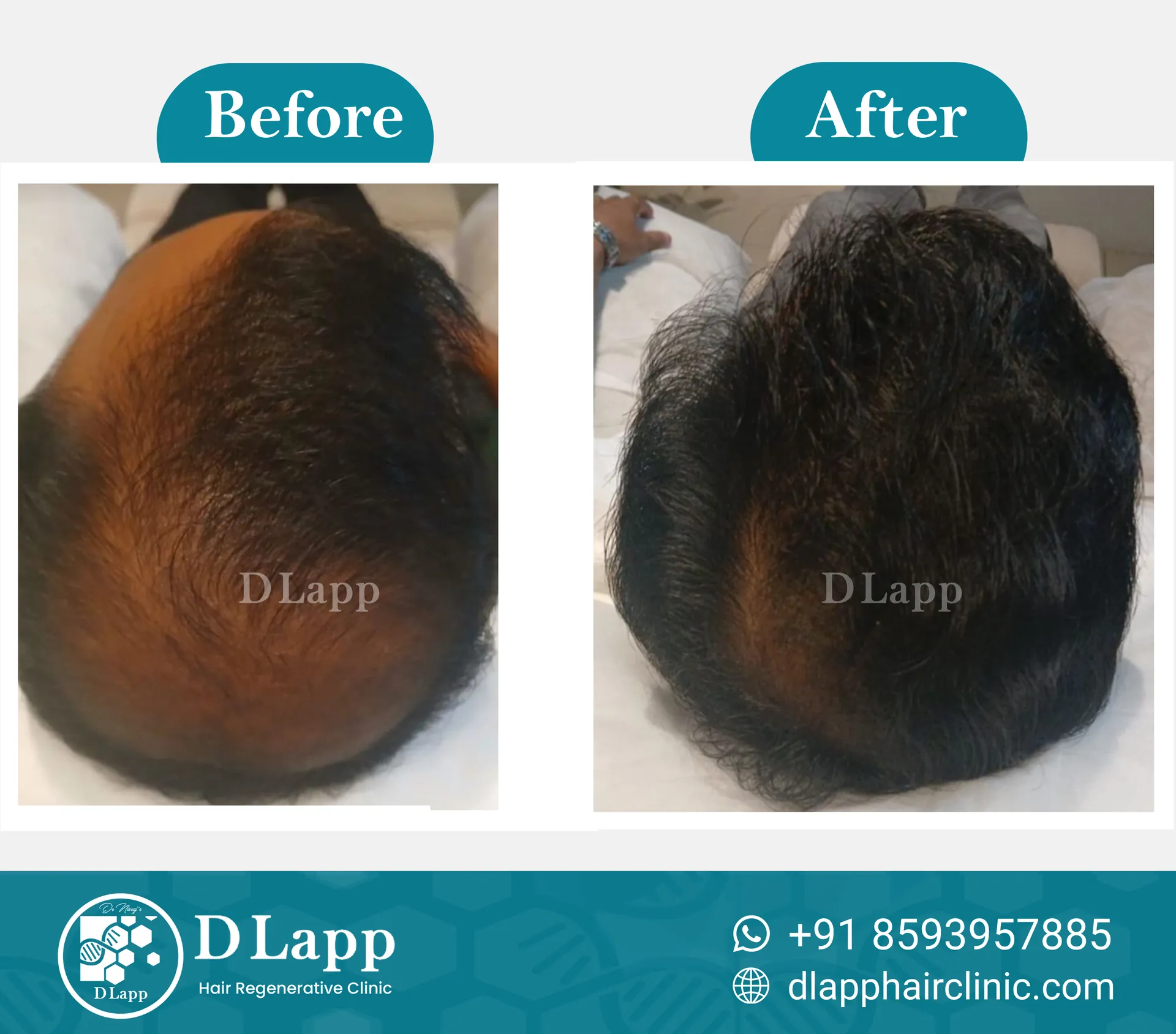 Before/After Medical Image