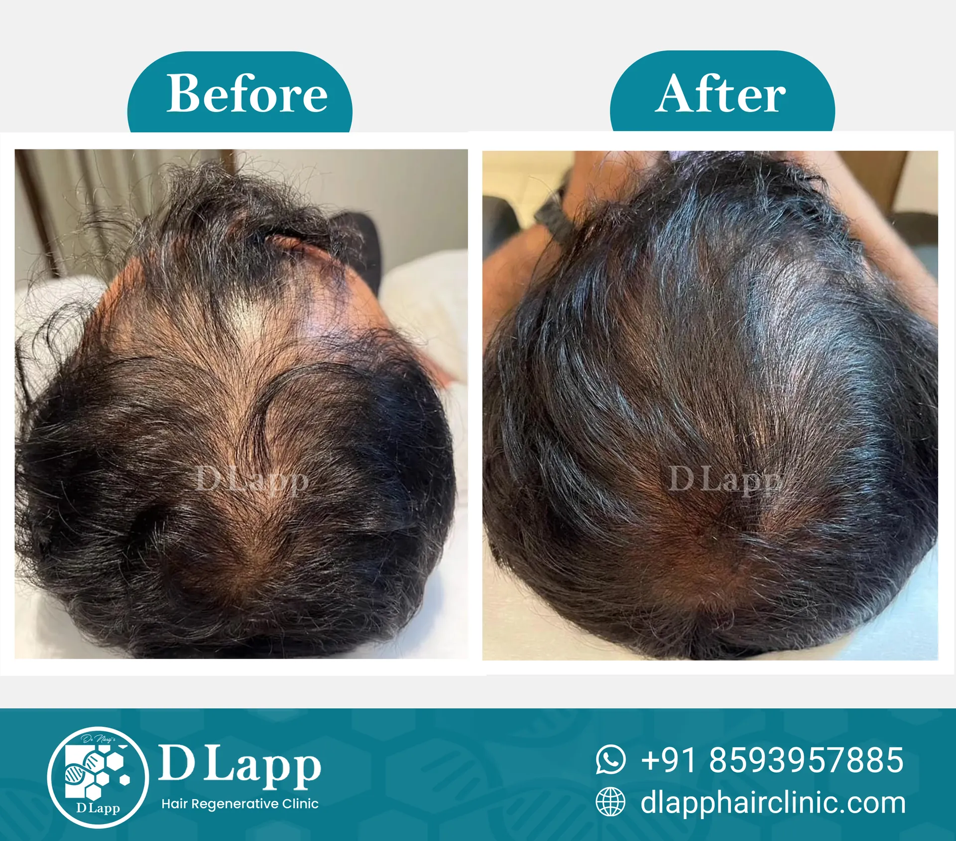 Before/After Medical Image