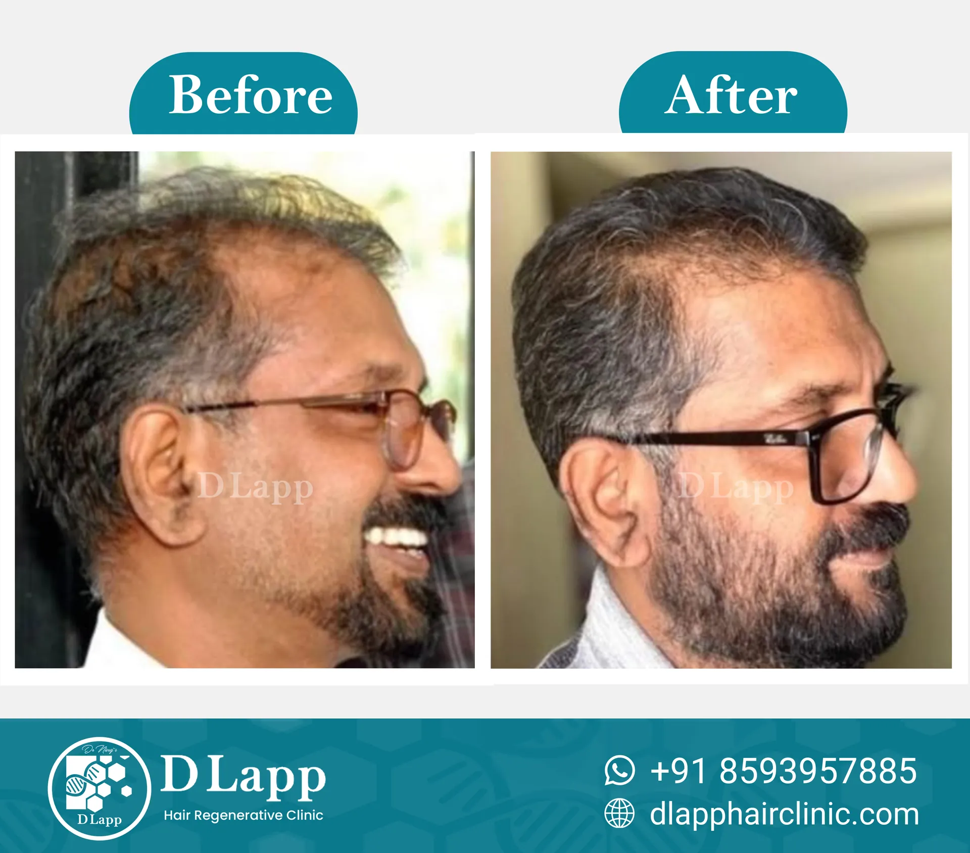 Before/After Medical Image