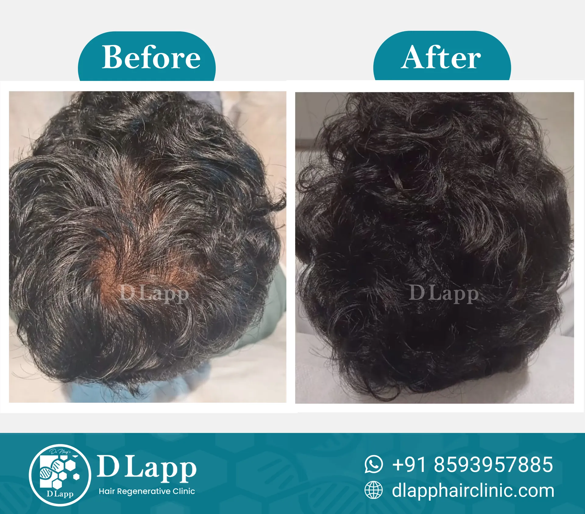 Before/After Medical Image