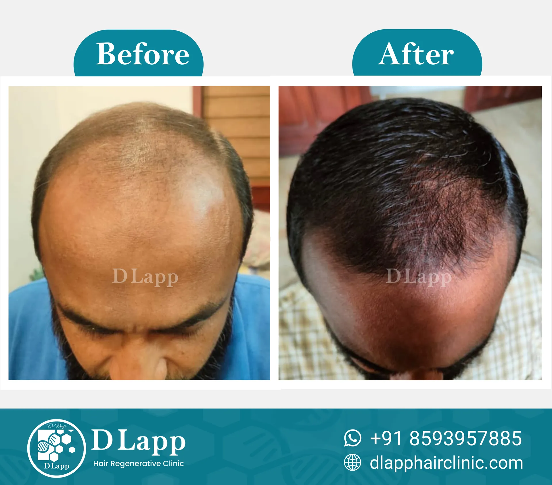 Before/After Medical Image