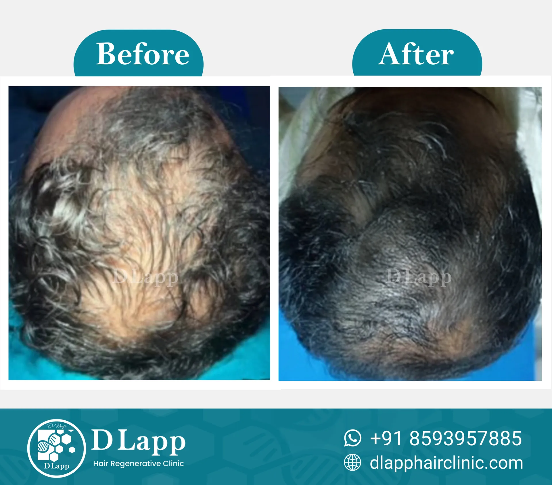Before/After Medical Image
