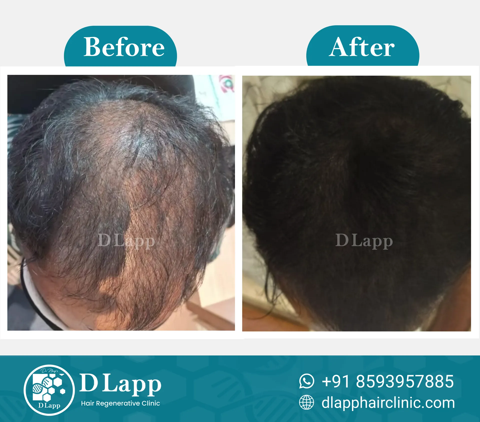 Before/After Medical Image