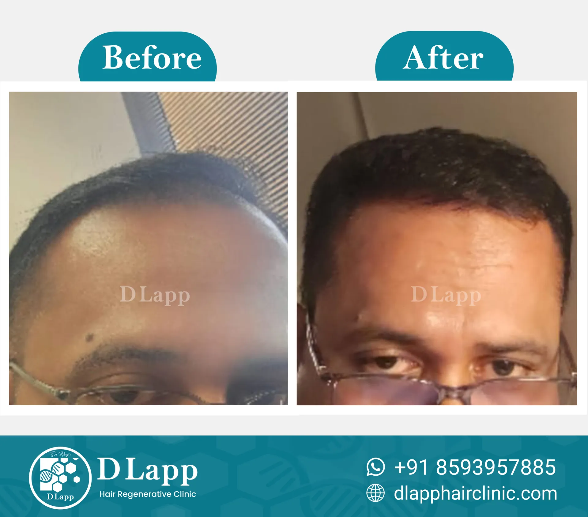 Before/After Medical Image