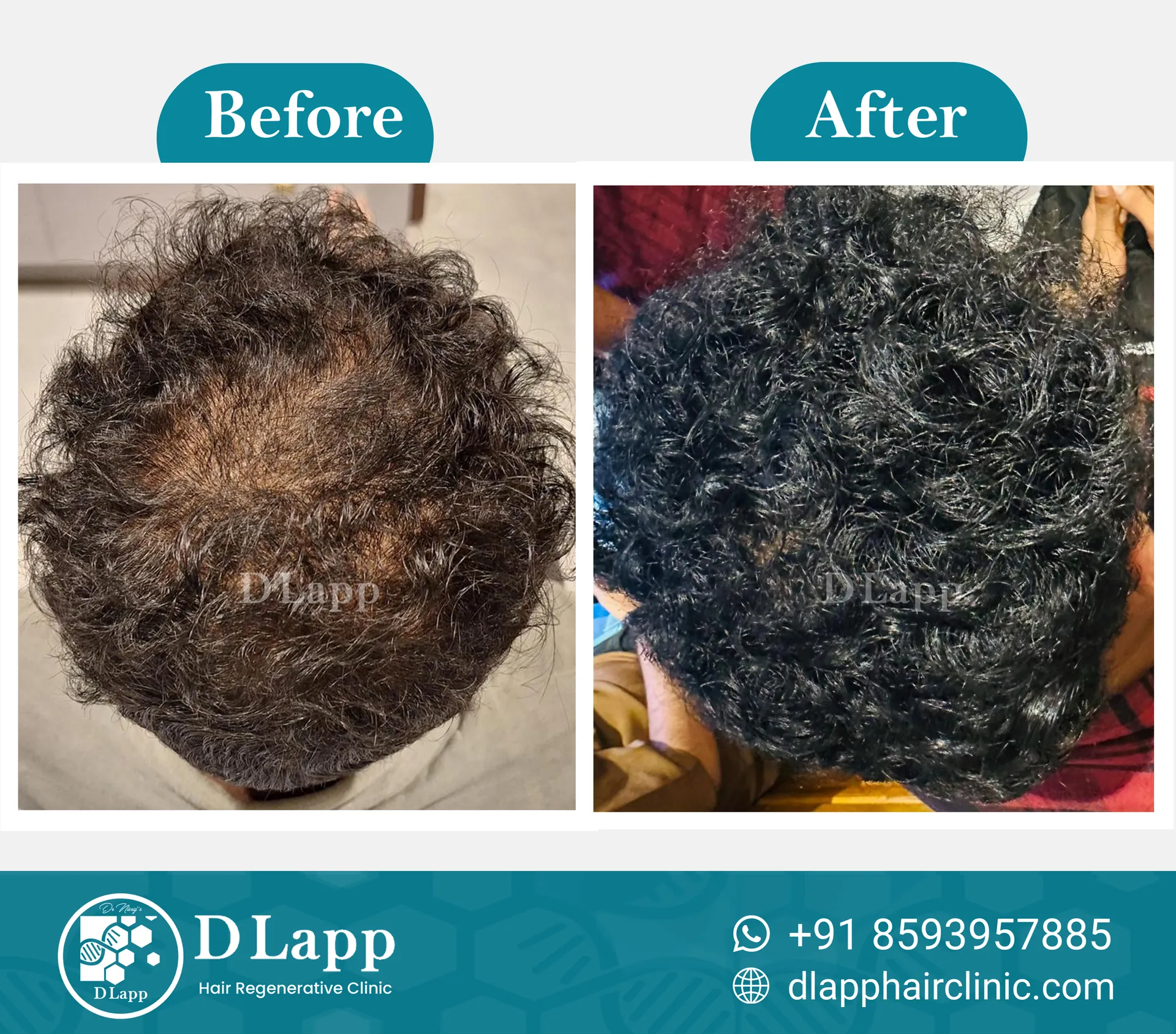 Before/After Medical Image