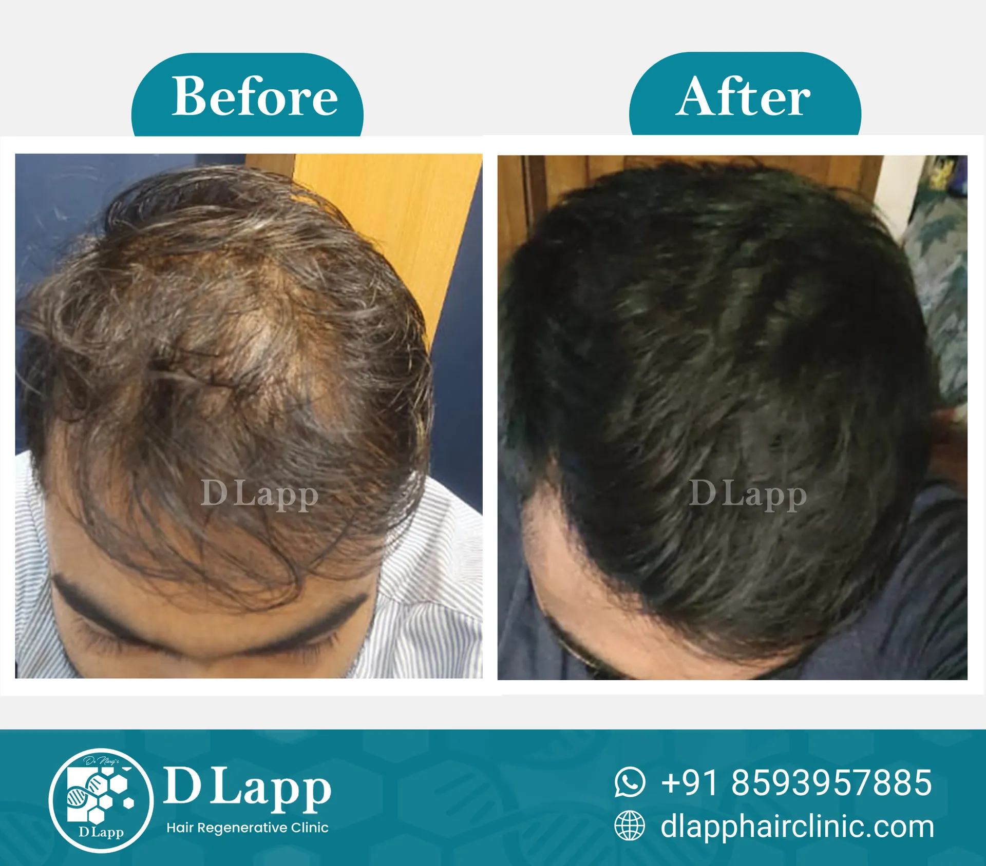 Before/After Medical Image