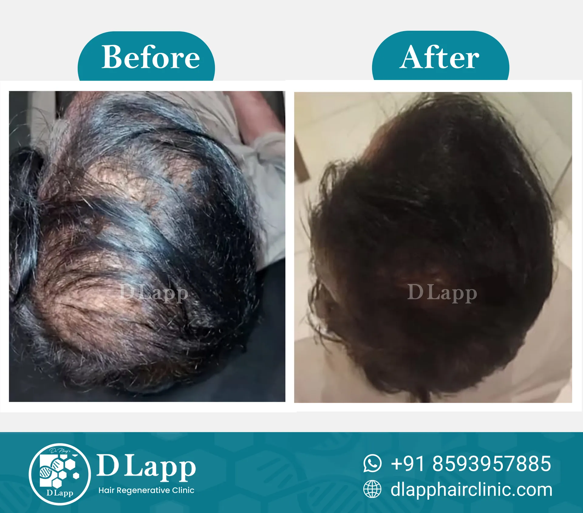 Before/After Medical Image