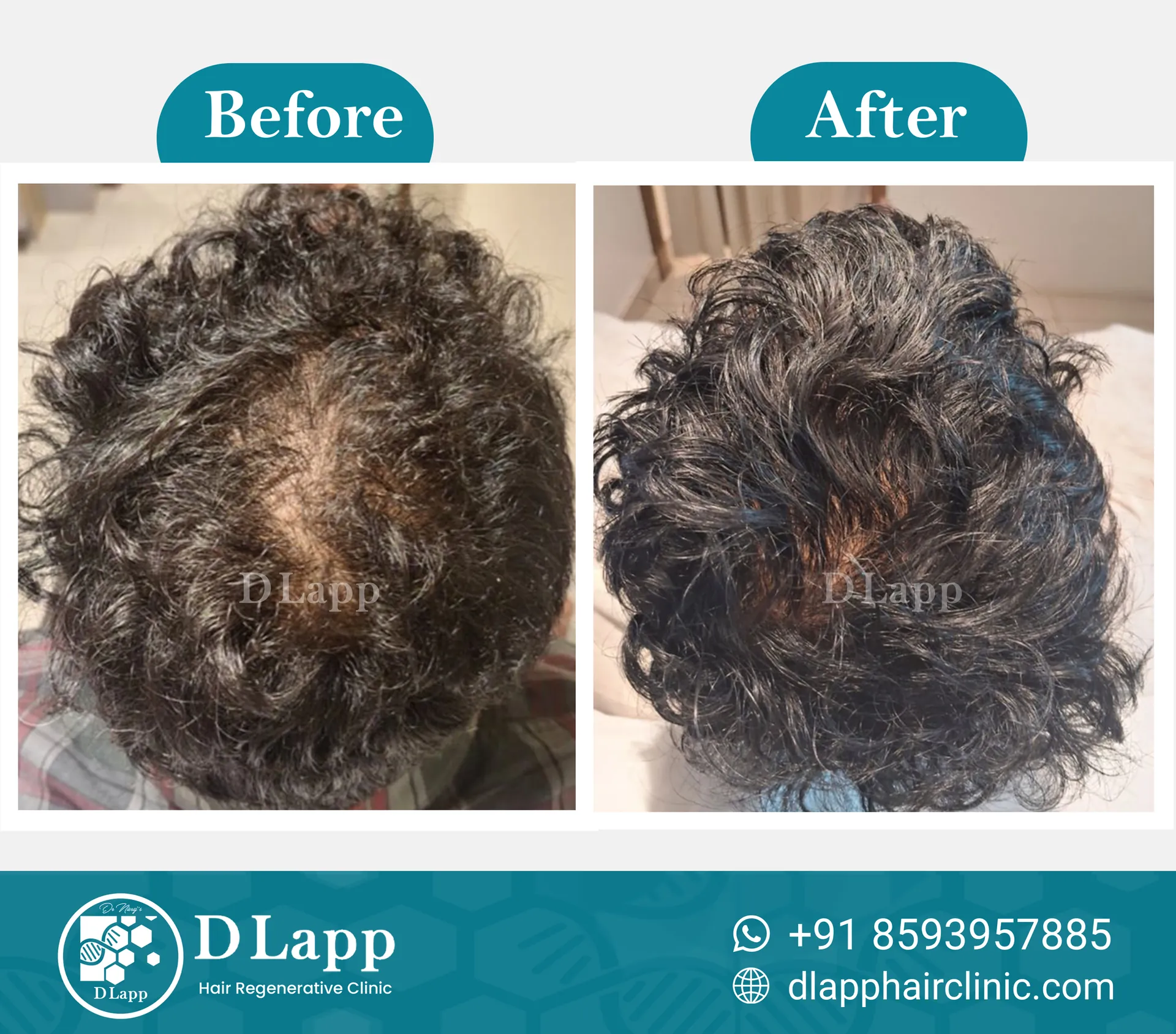 Before/After Medical Image