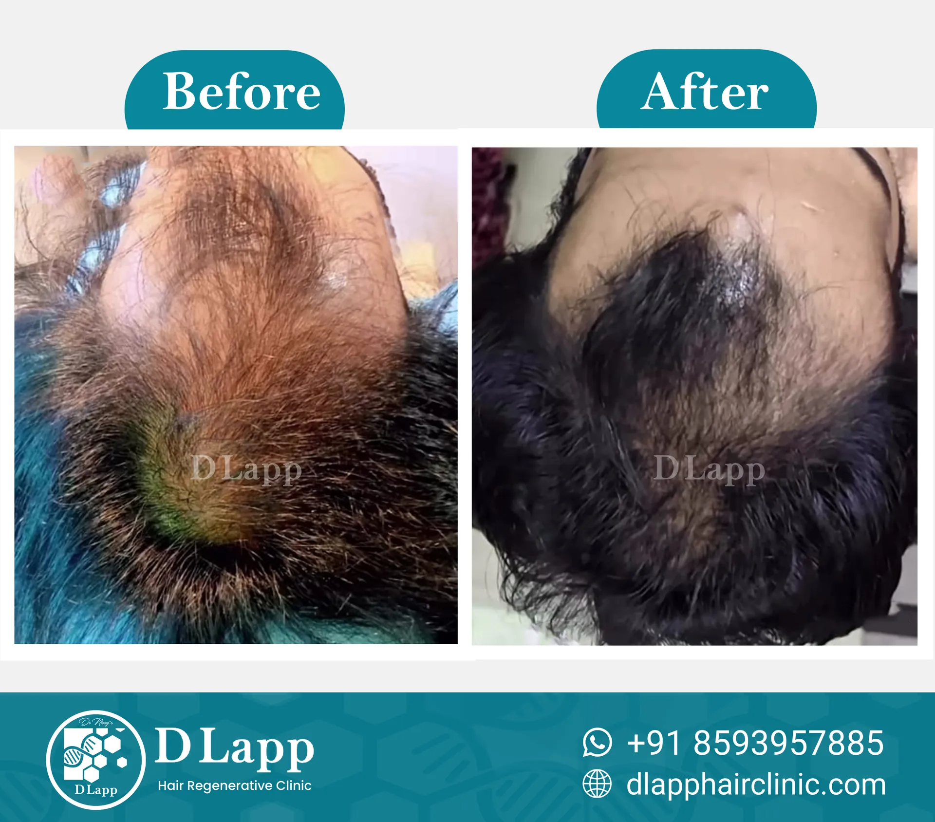 Before/After Medical Image