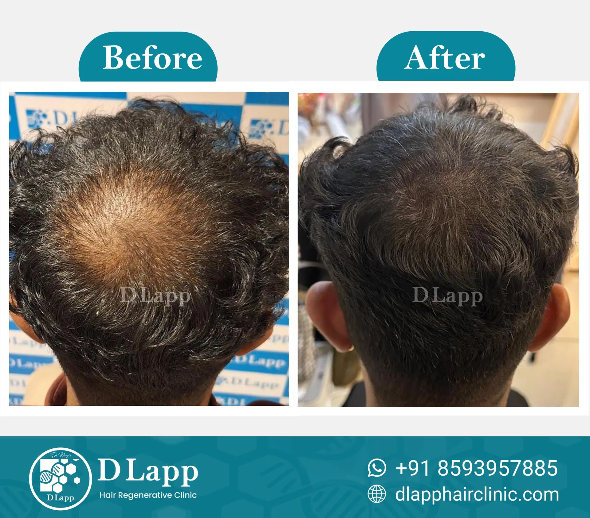 Before/After Medical Image