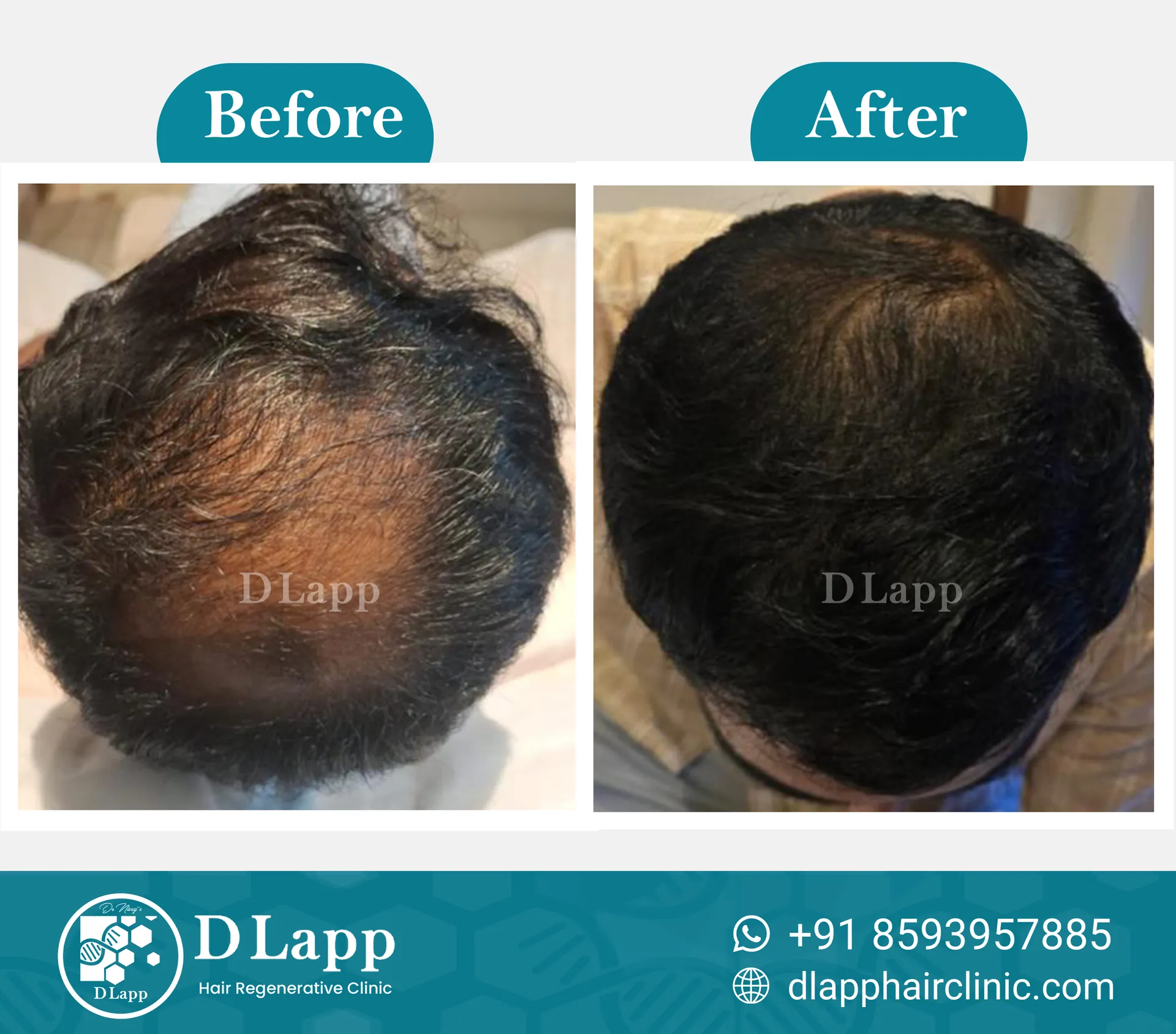 Before/After Medical Image