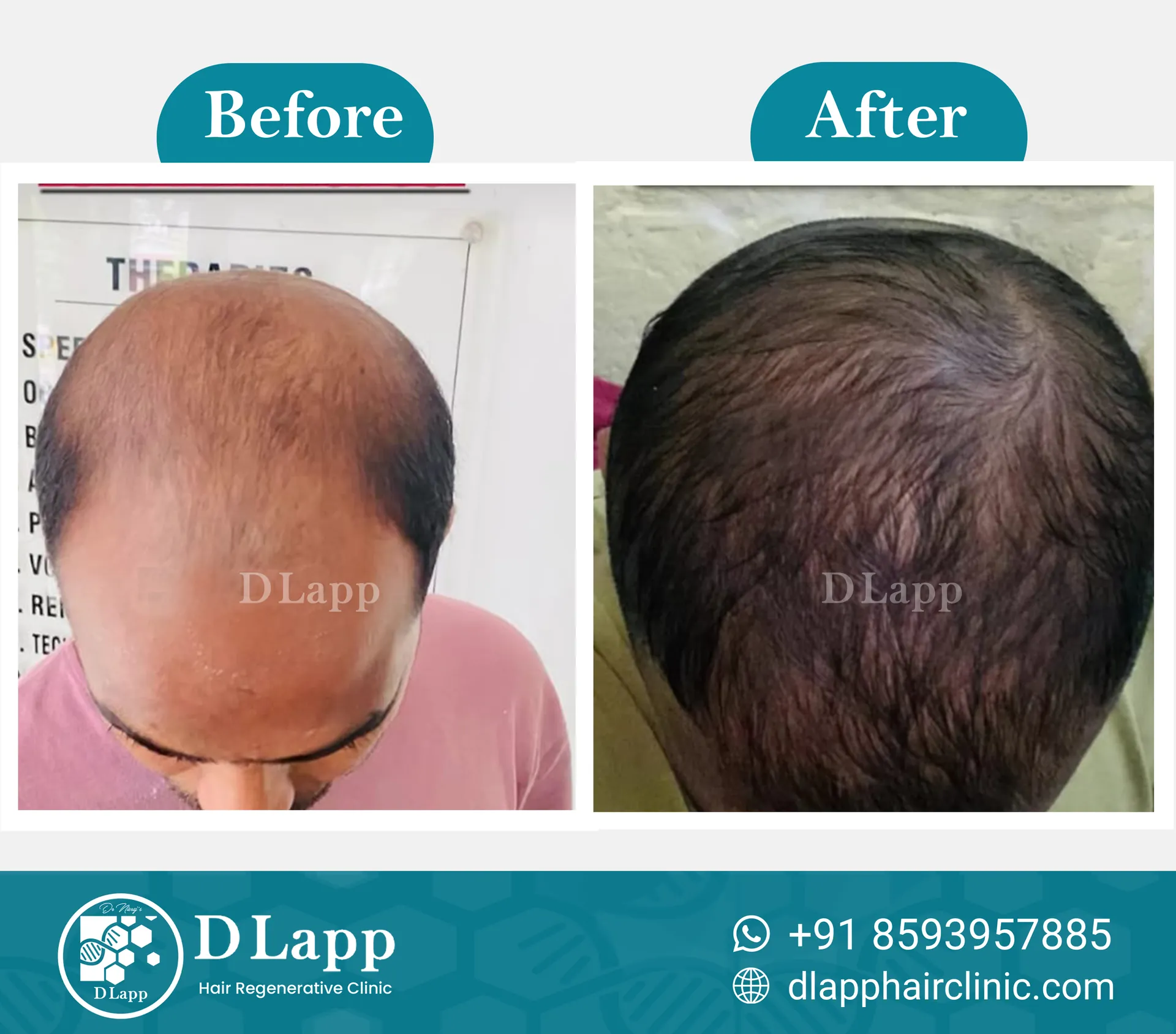 Before/After Medical Image