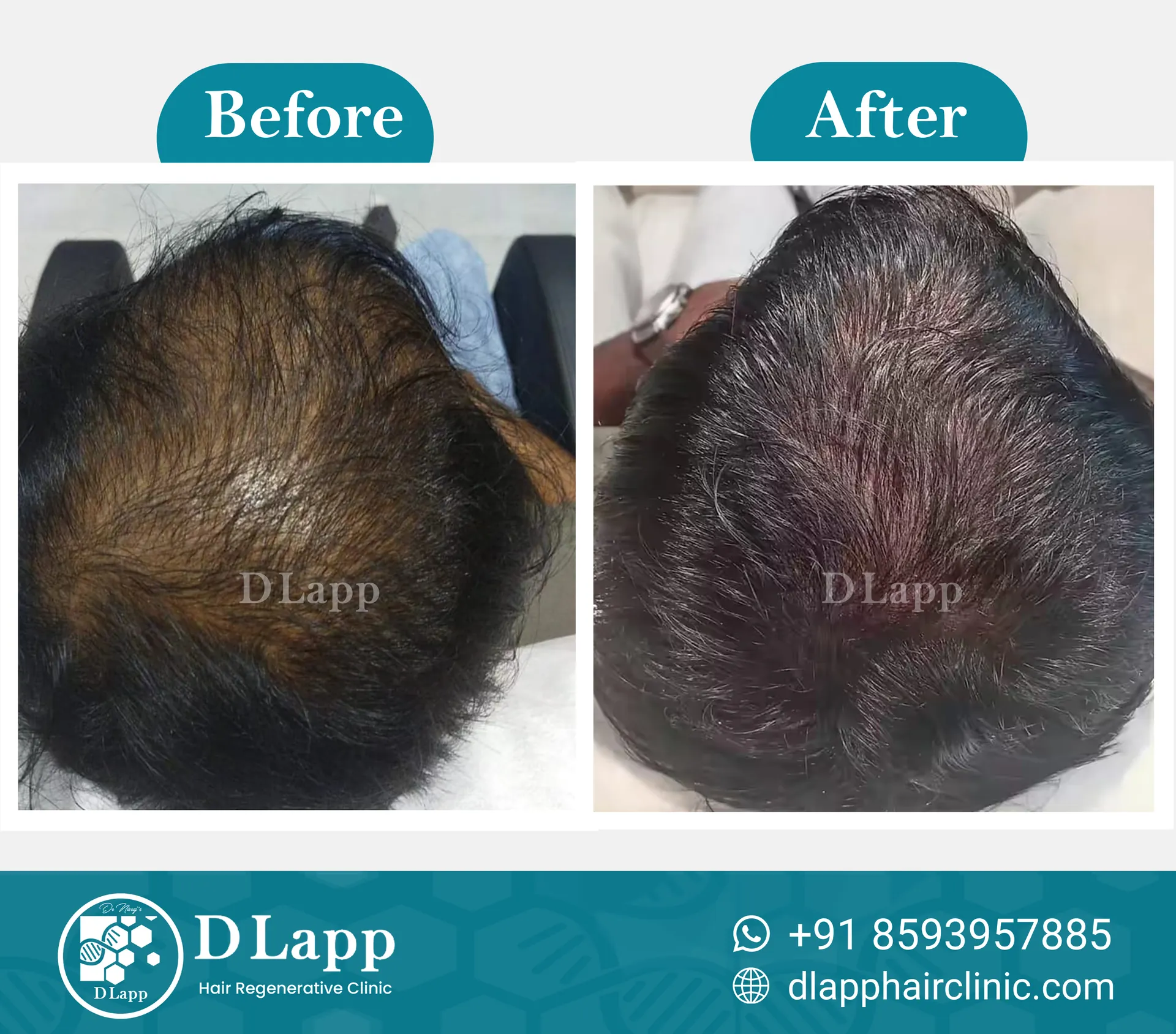Before/After Medical Image