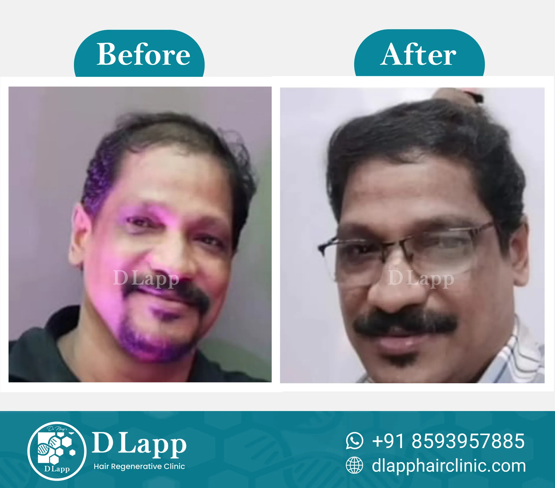 Before/After Medical Image