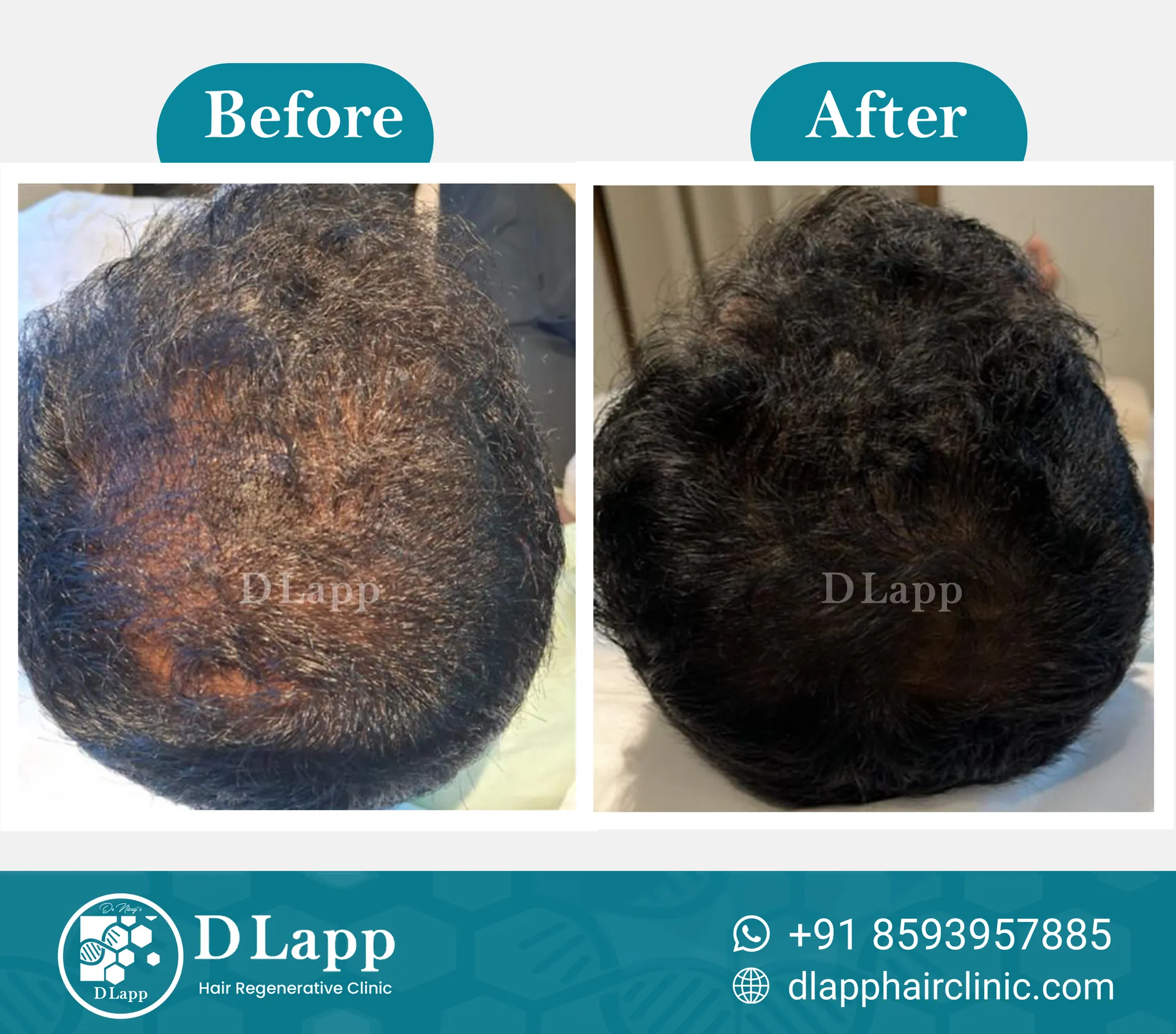 Before/After Medical Image