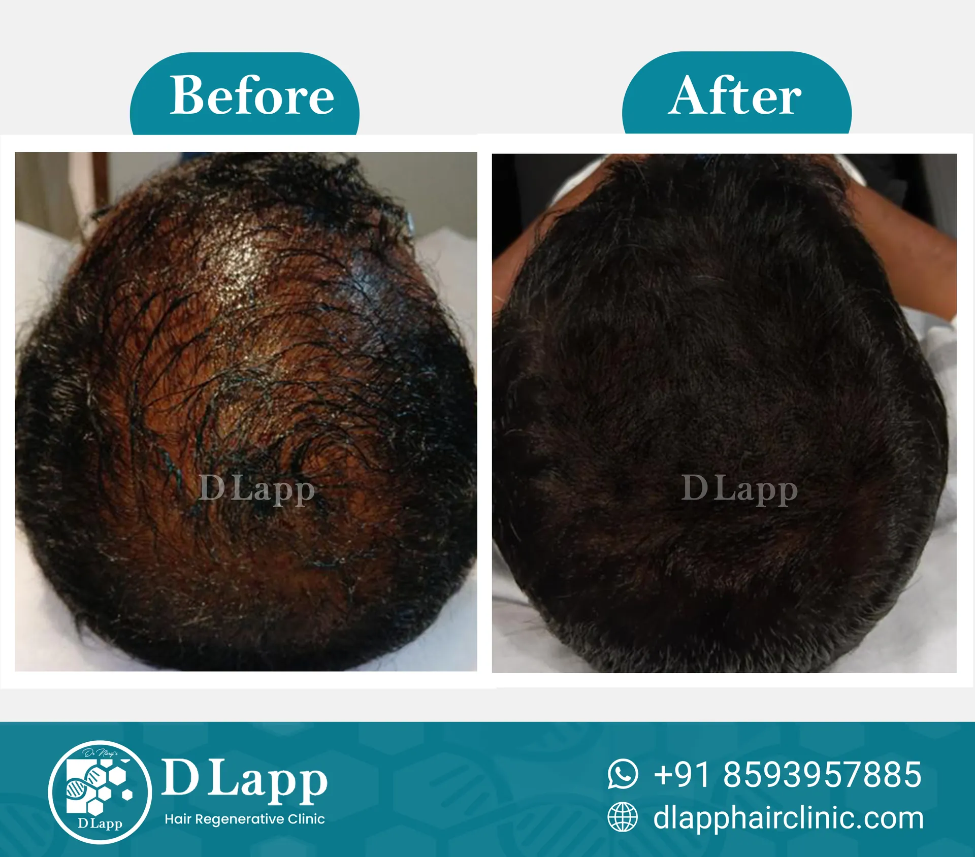 Before/After Medical Image