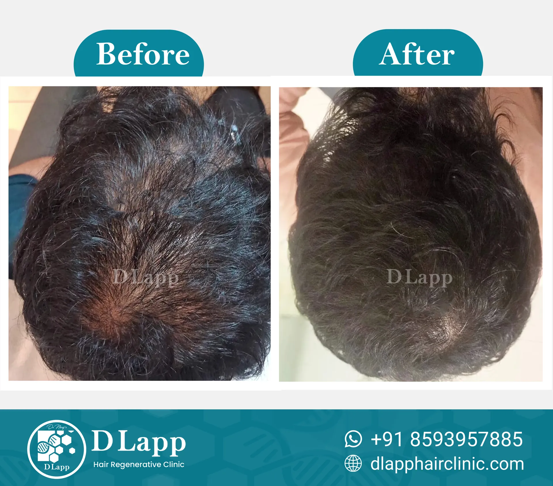 Before/After Medical Image