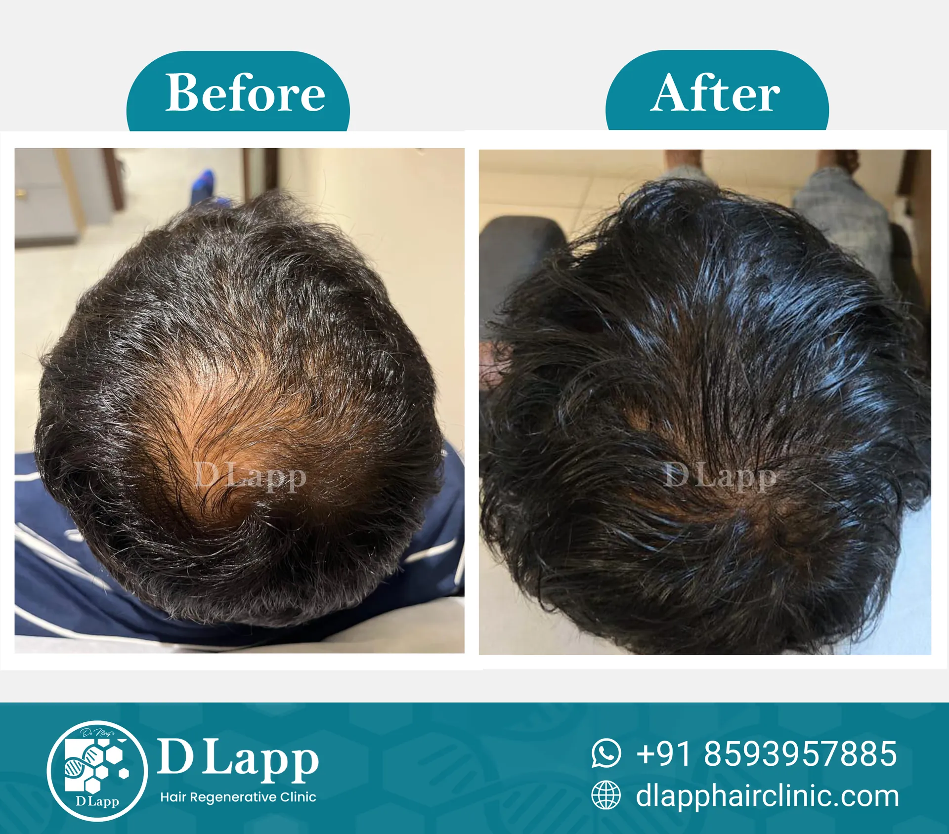Before/After Medical Image