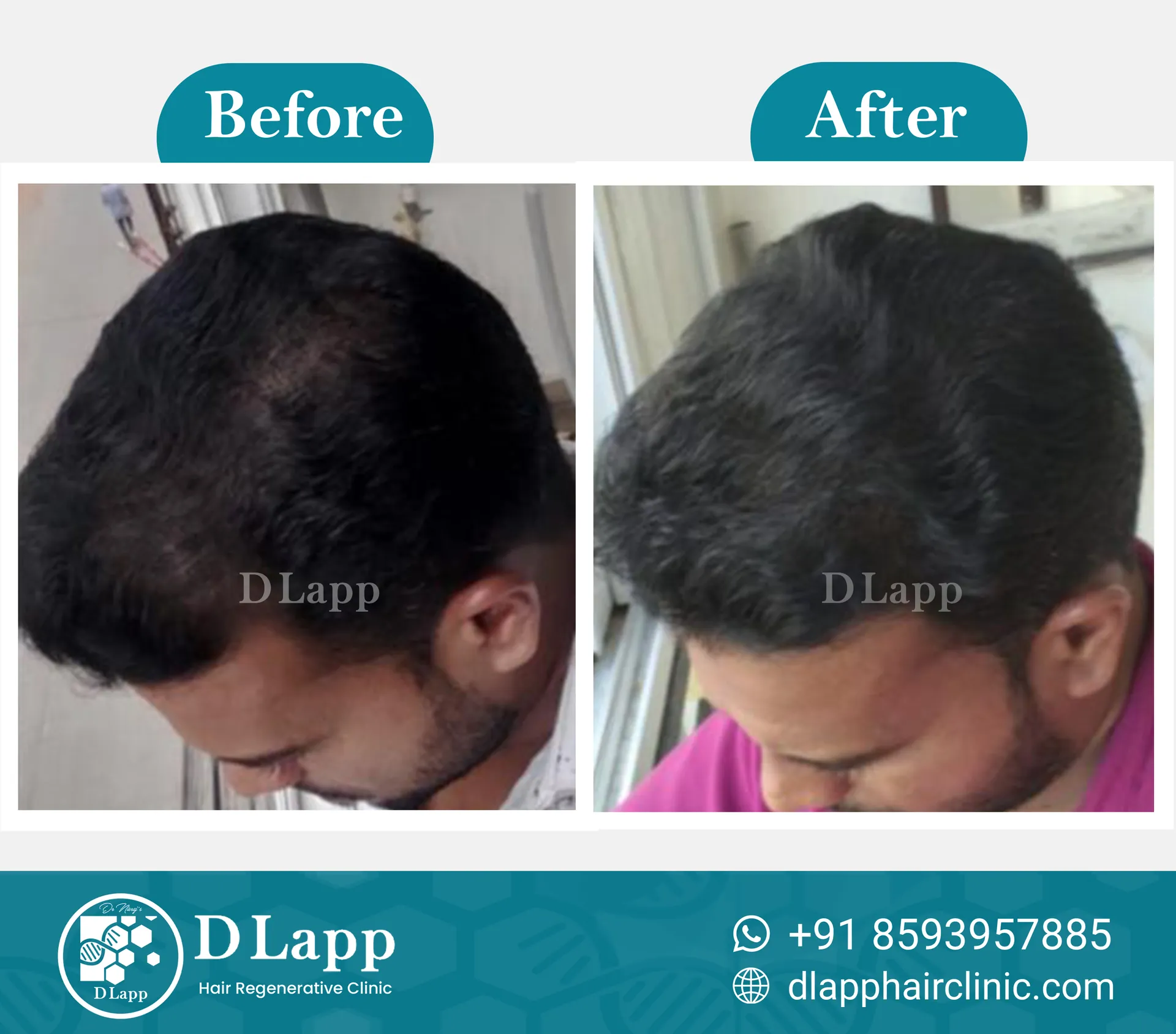 Before/After Medical Image