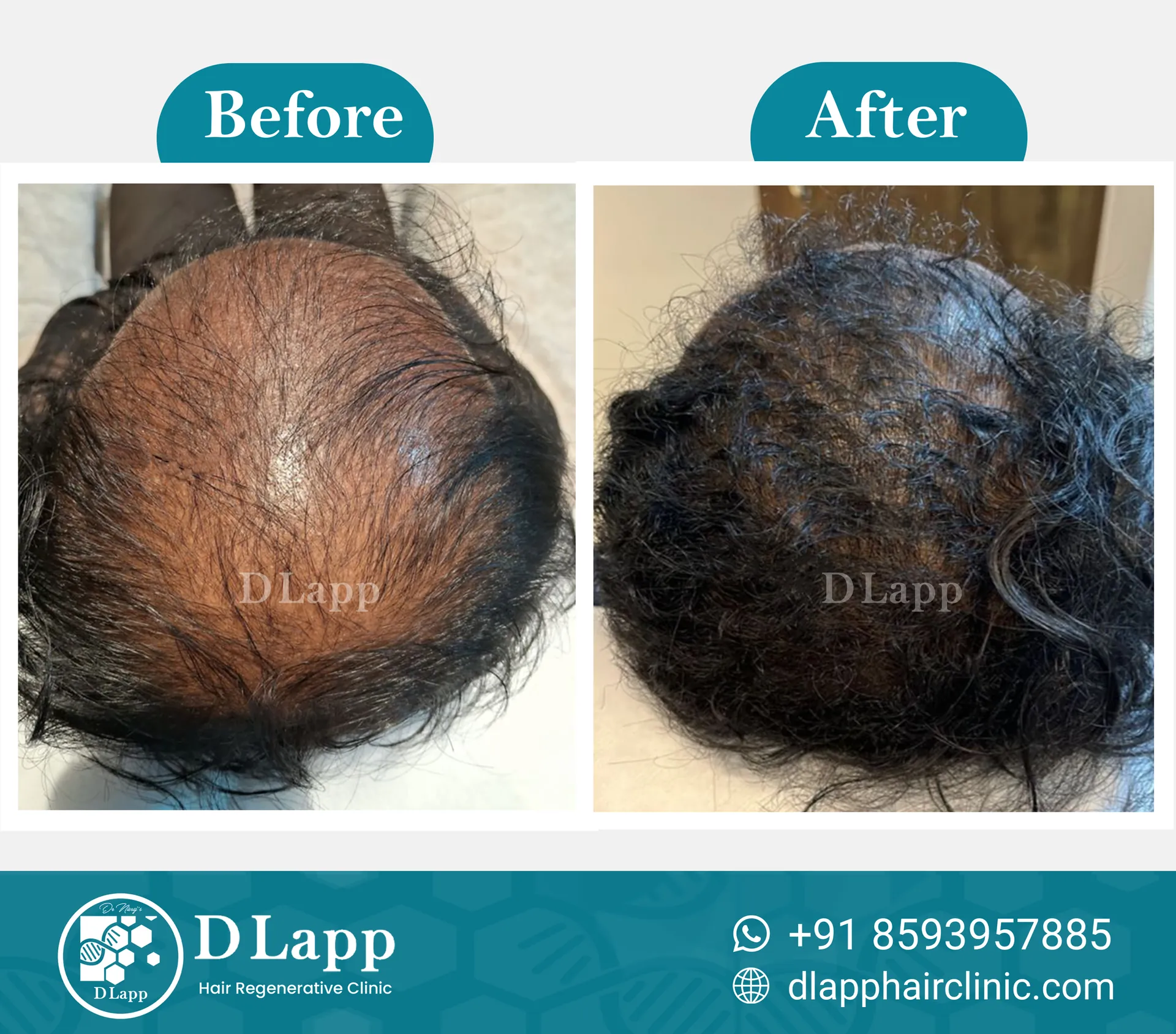 Before/After Medical Image