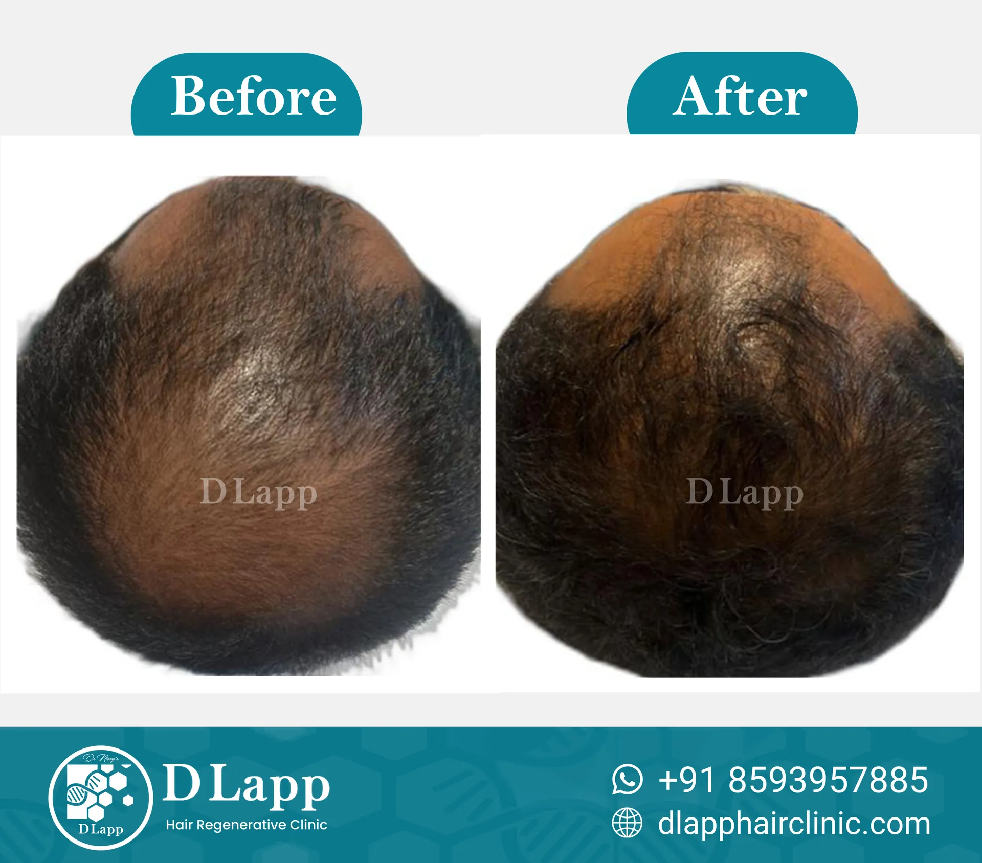 Before/After Medical Image