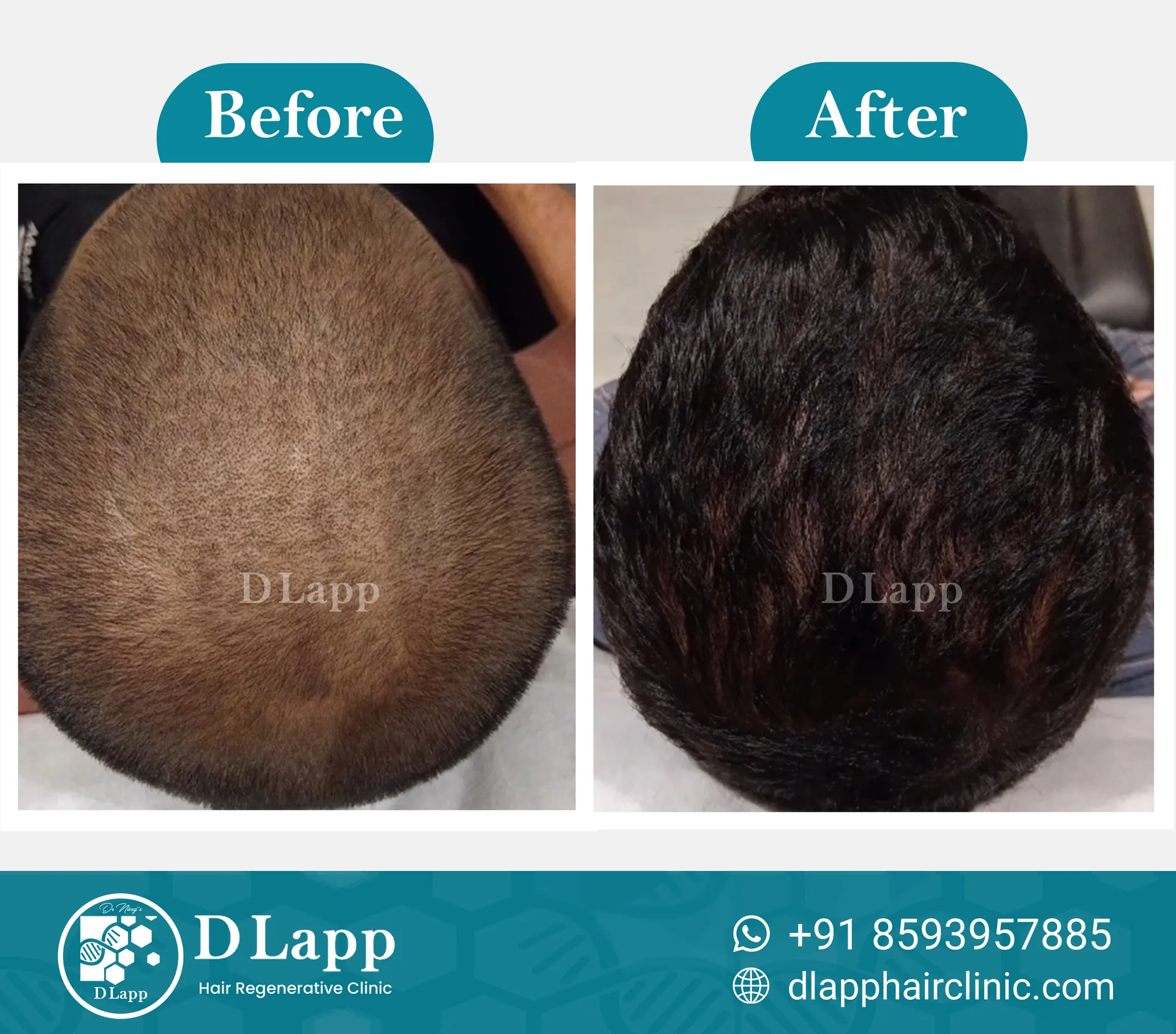 Before/After Medical Image