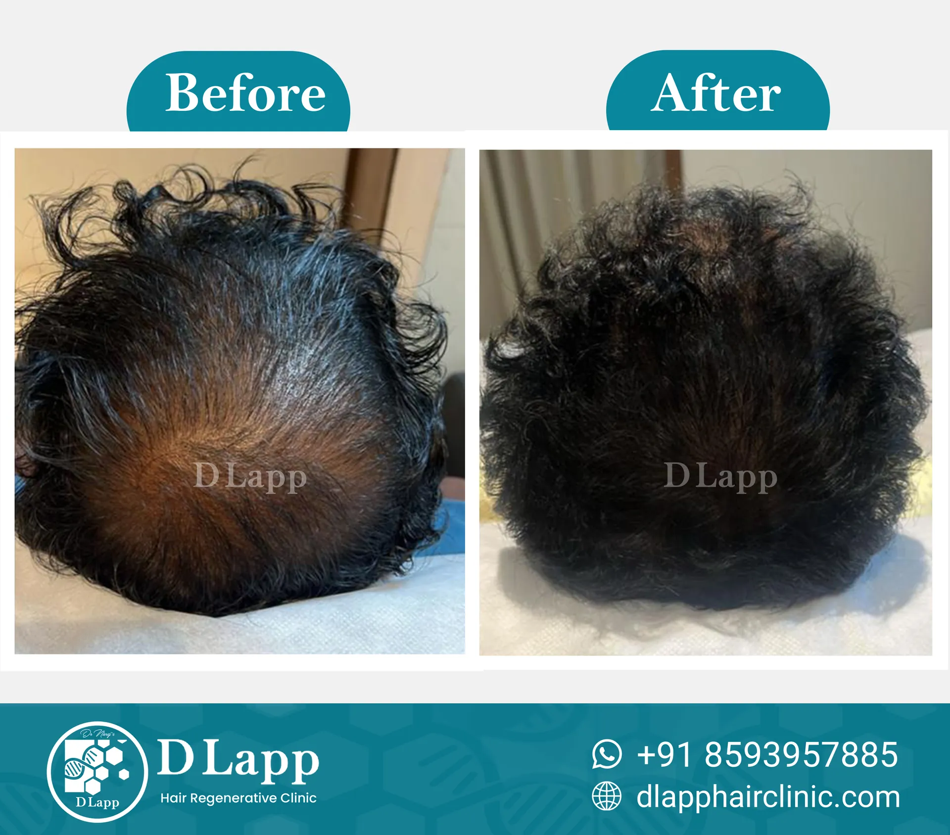 Before/After Medical Image