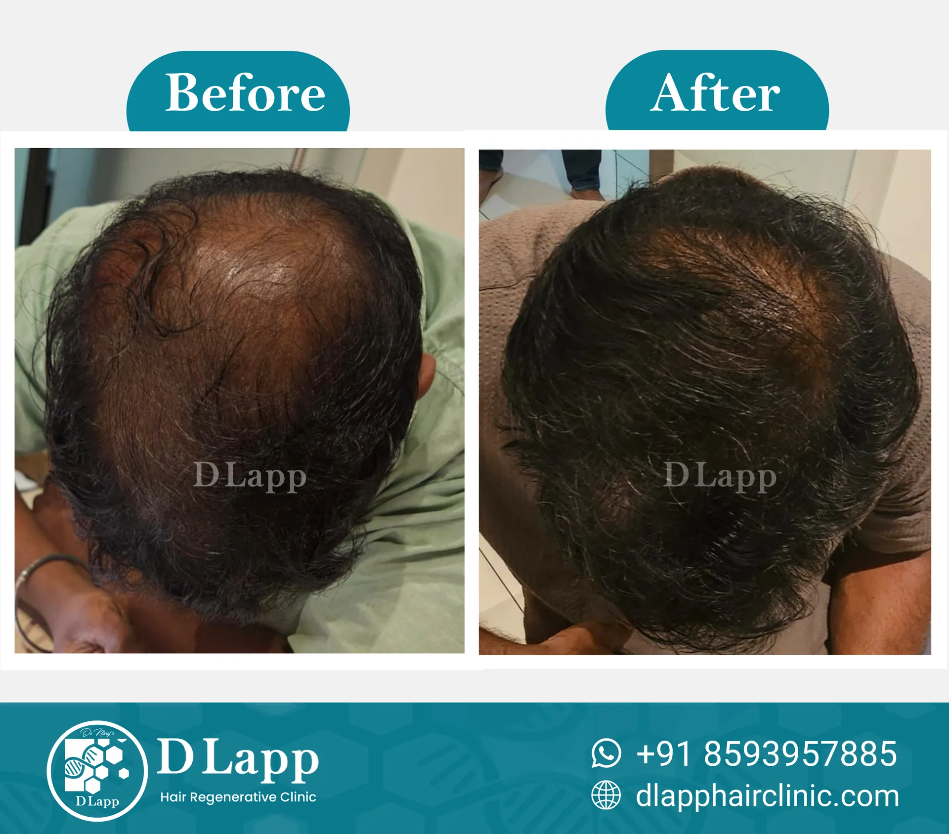 Before/After Medical Image