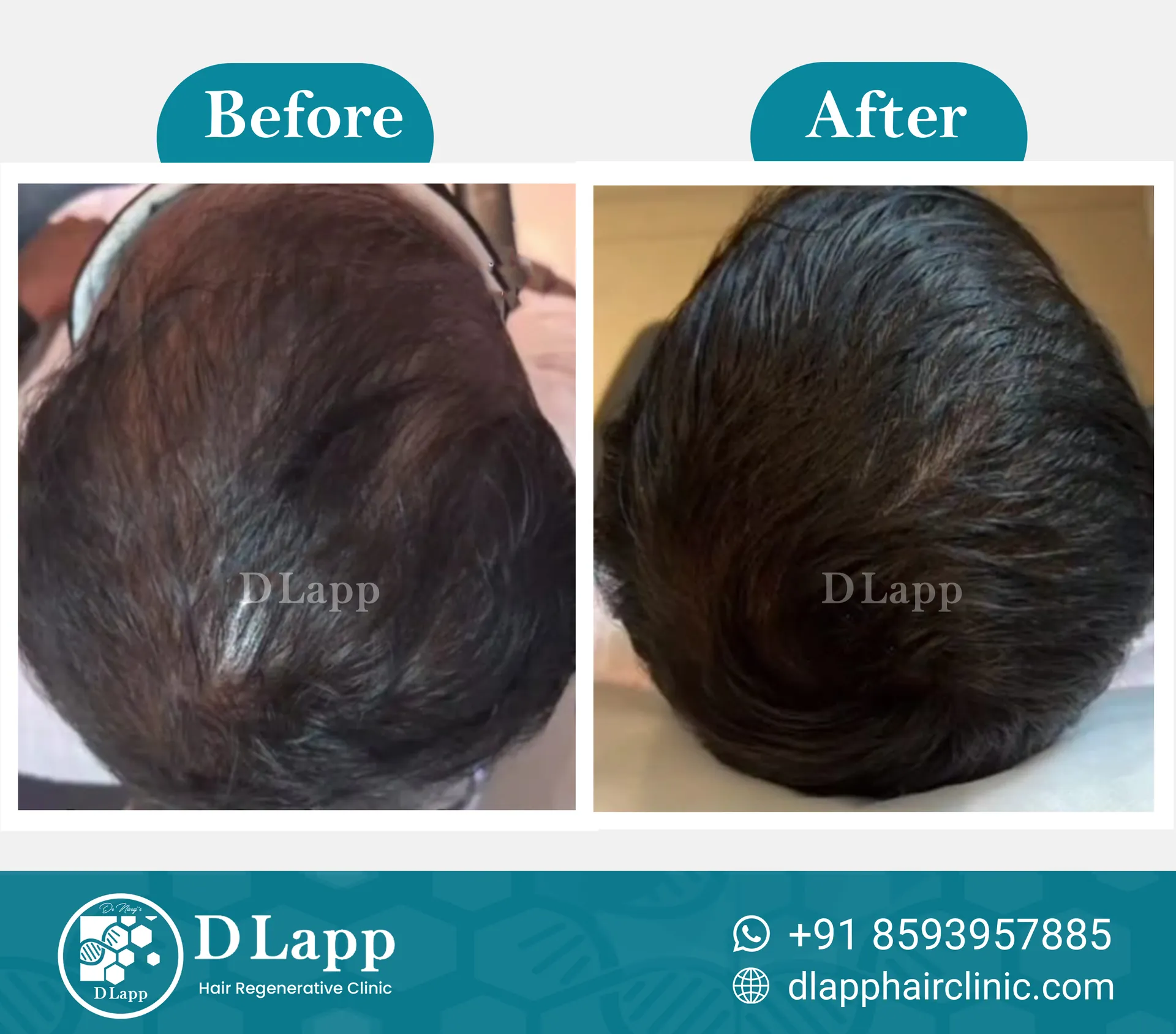 Before/After Medical Image