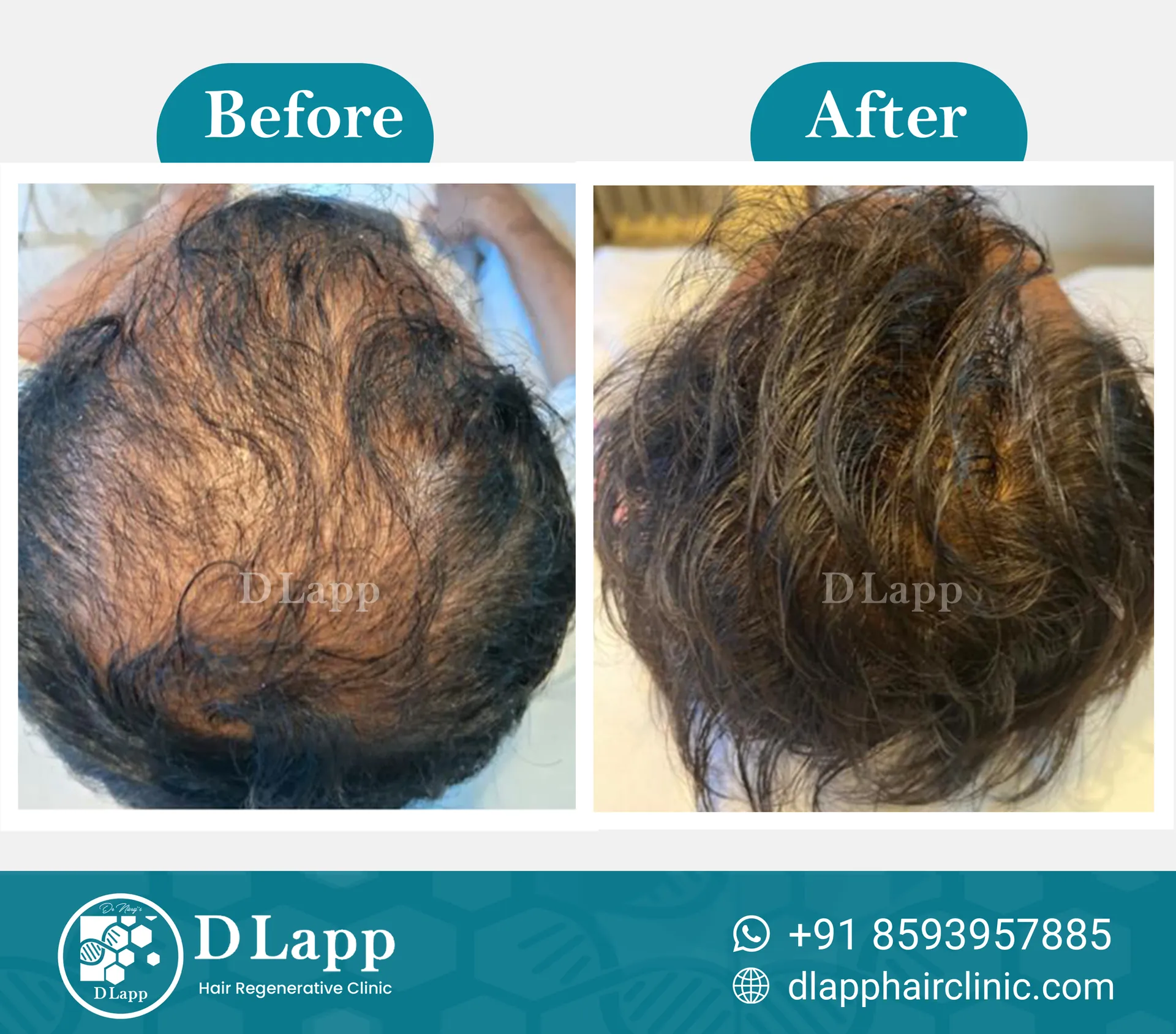 Before/After Medical Image