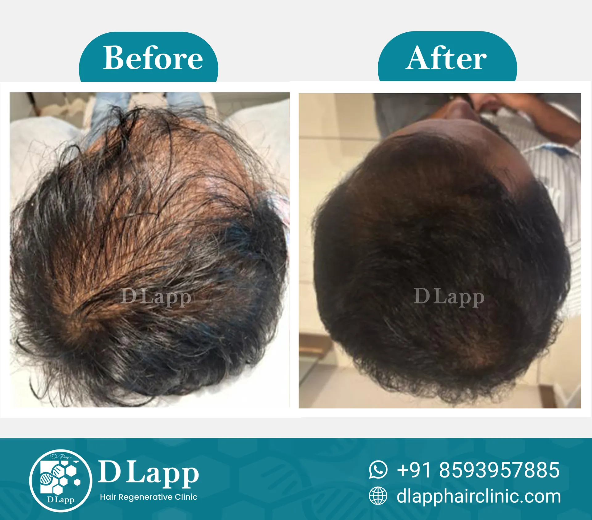Before/After Medical Image