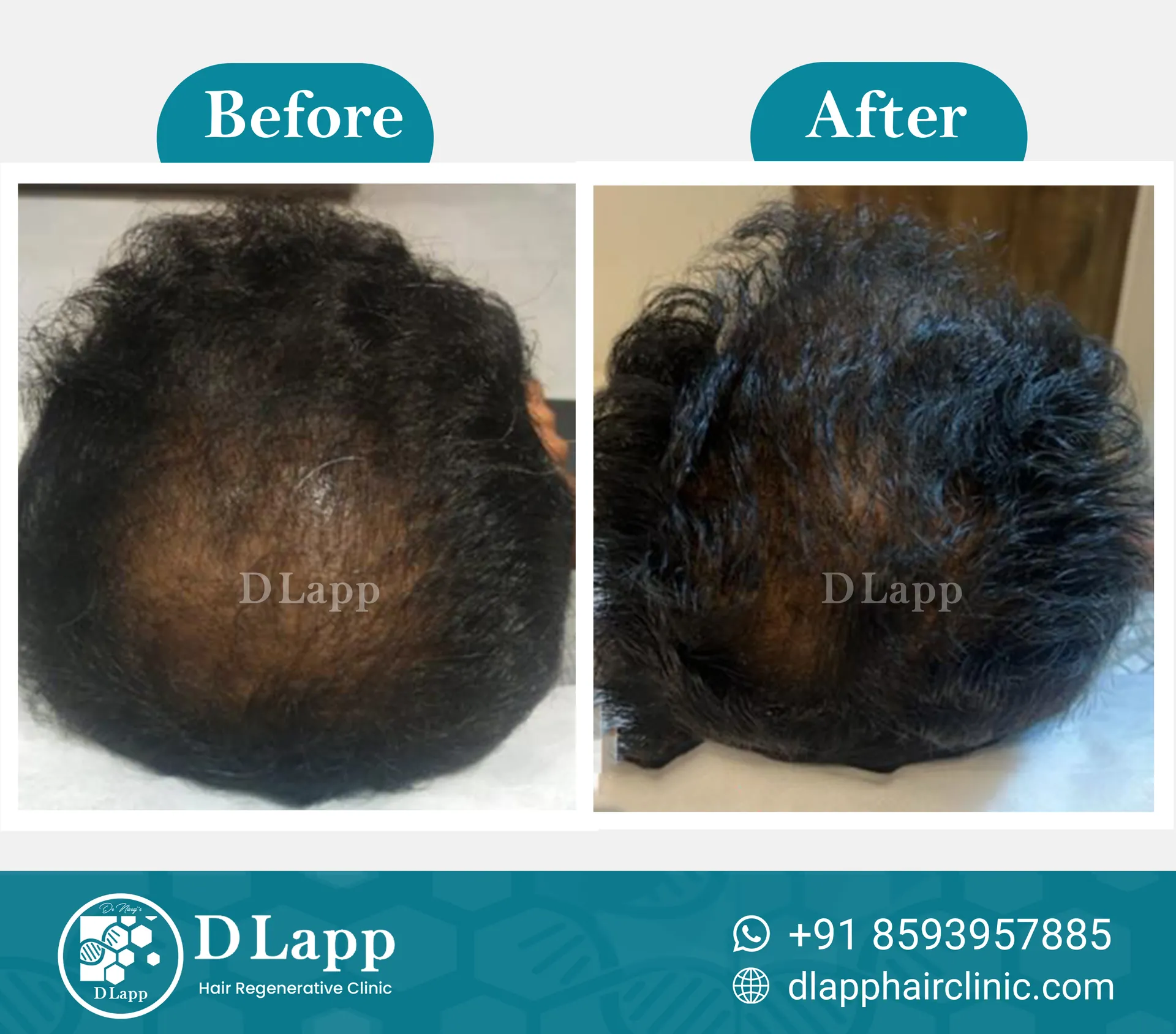 Before/After Medical Image