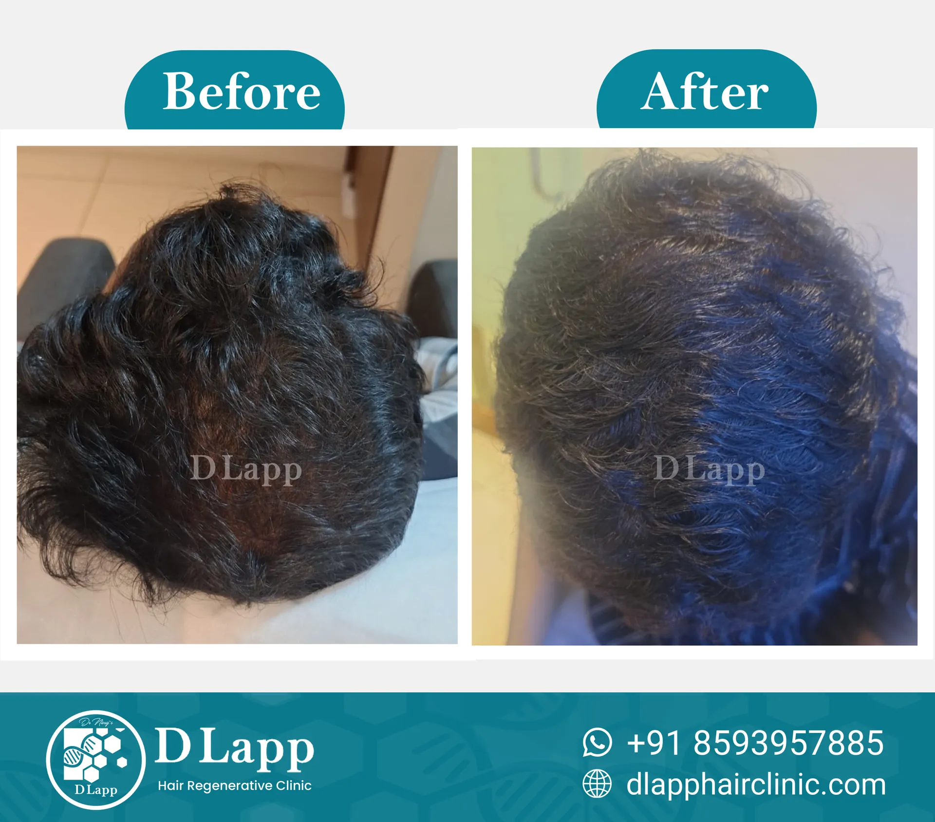 Before/After Medical Image