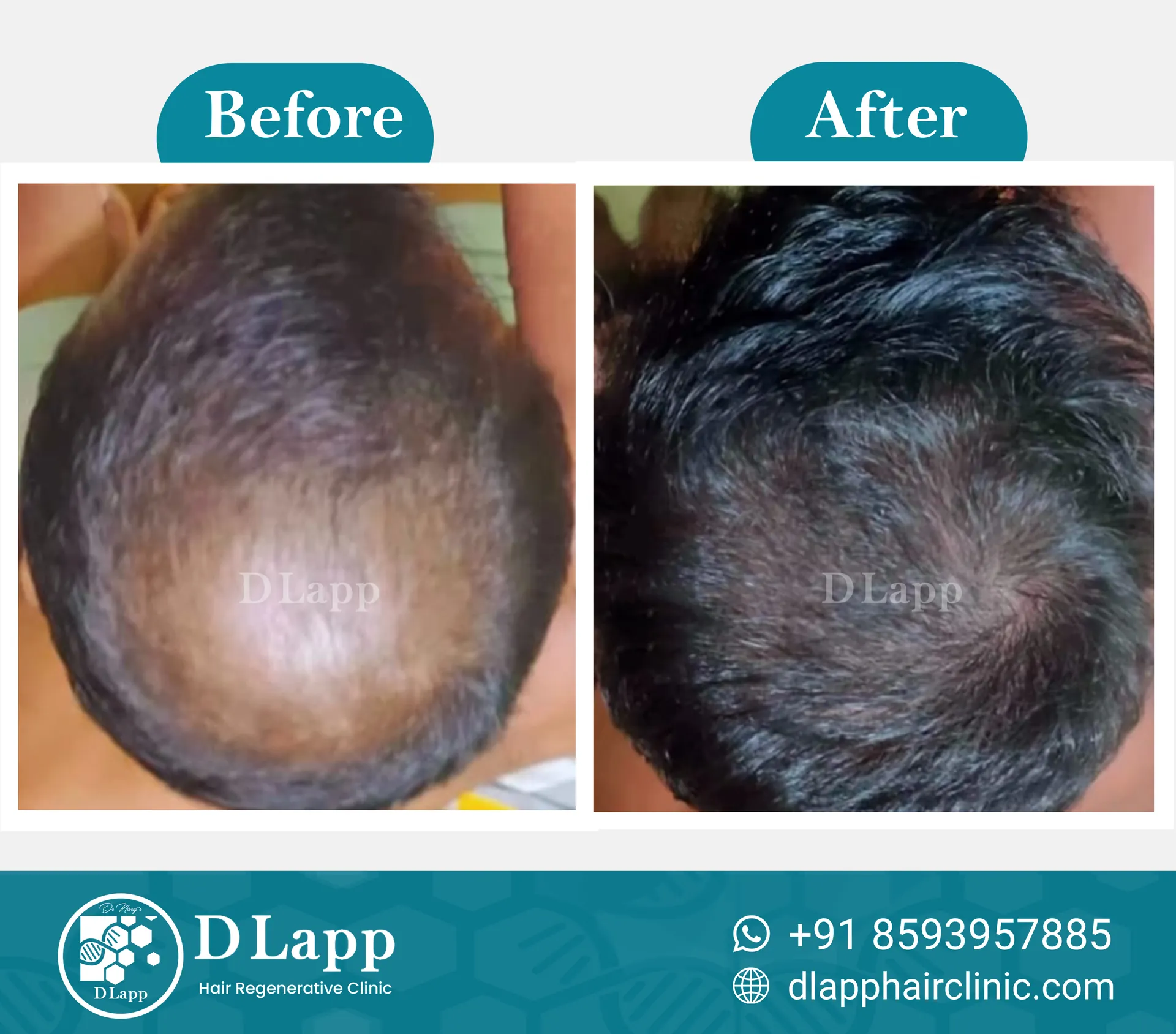 Before/After Medical Image