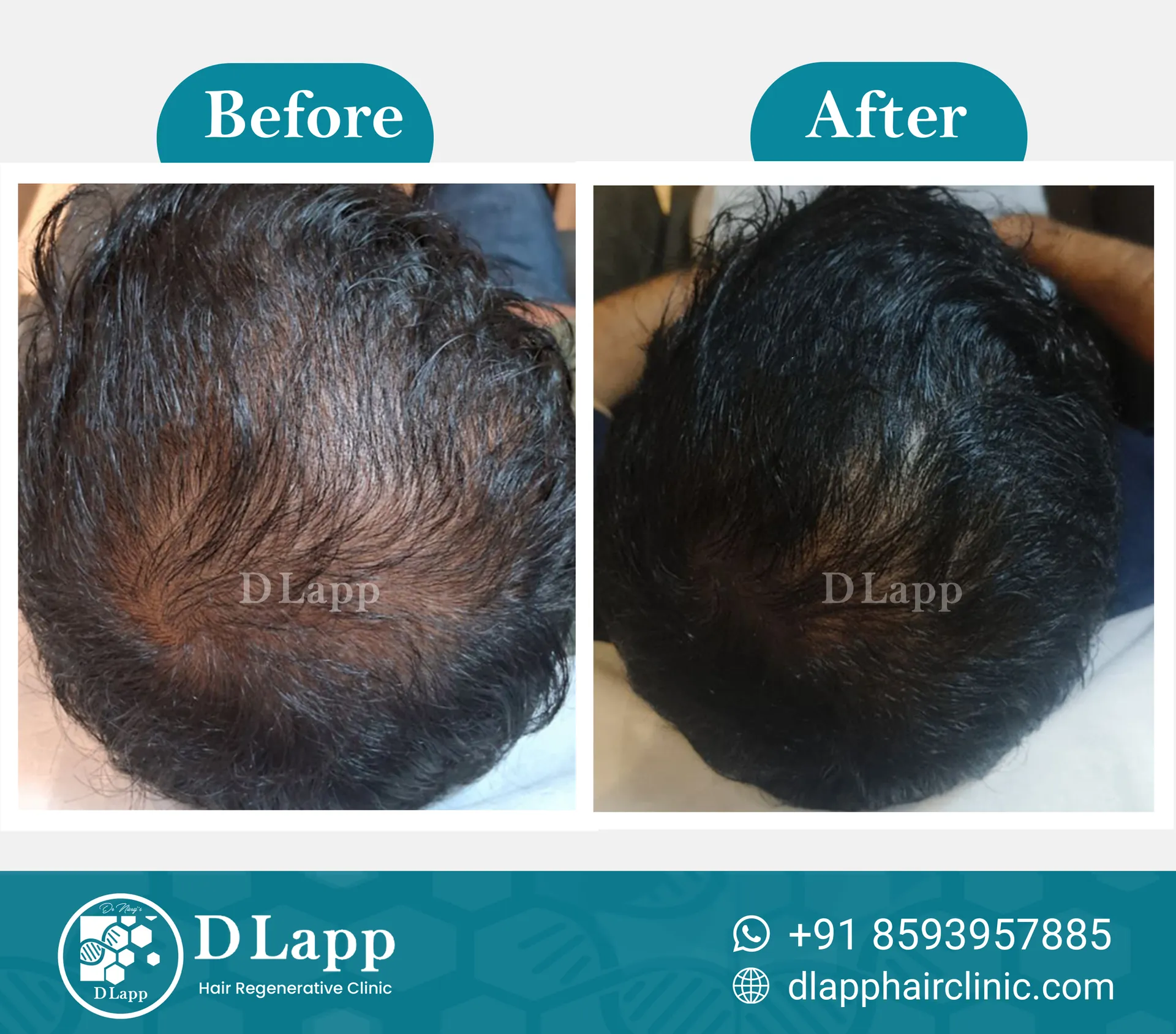 Before/After Medical Image