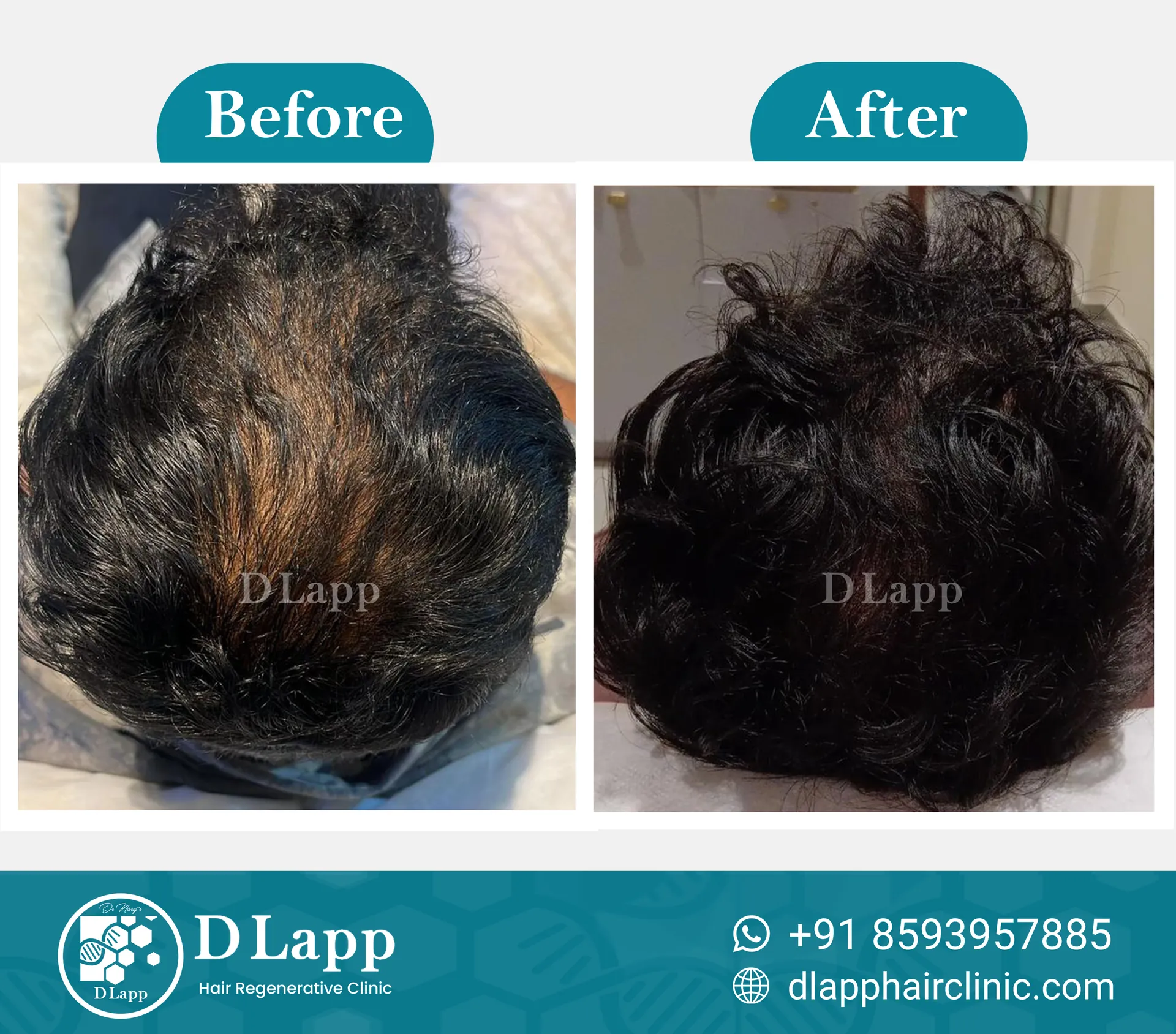 Before/After Medical Image