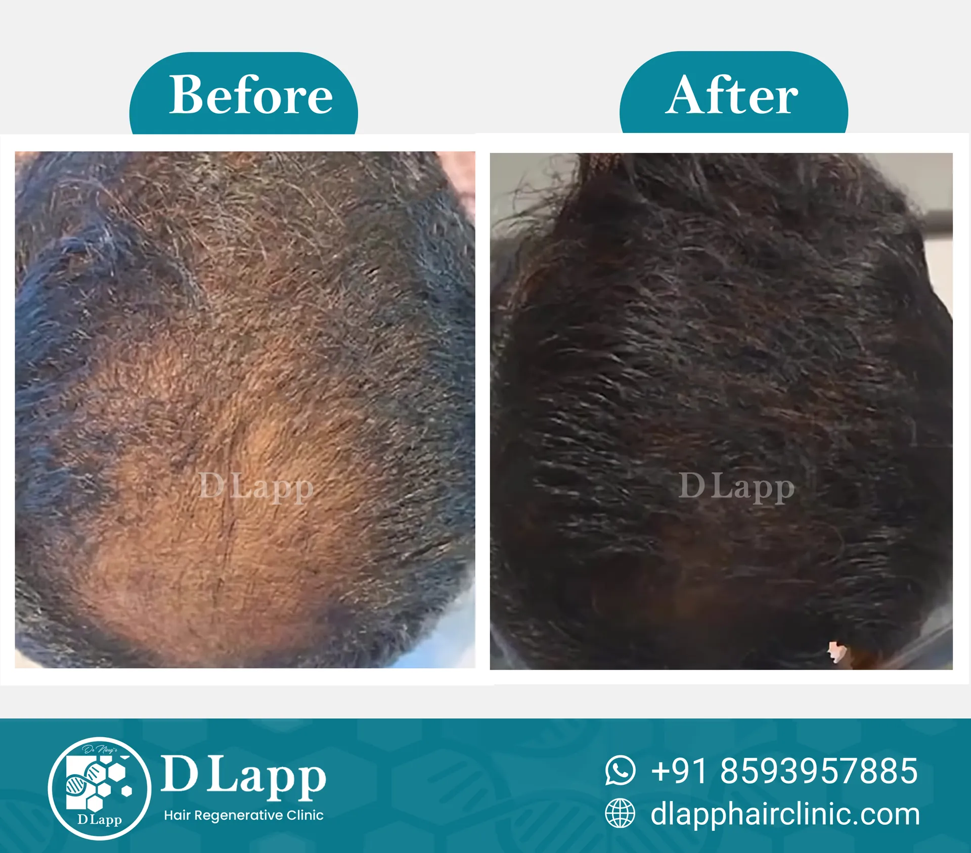Before/After Medical Image