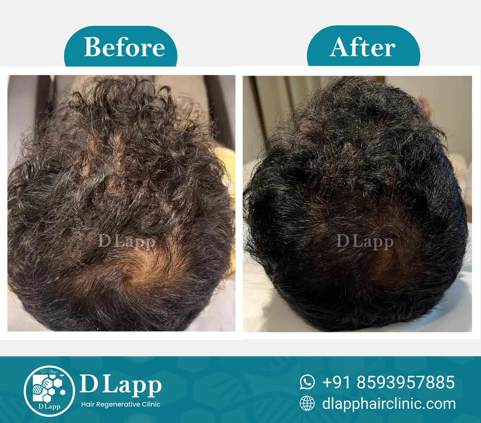 Before/After Medical Image