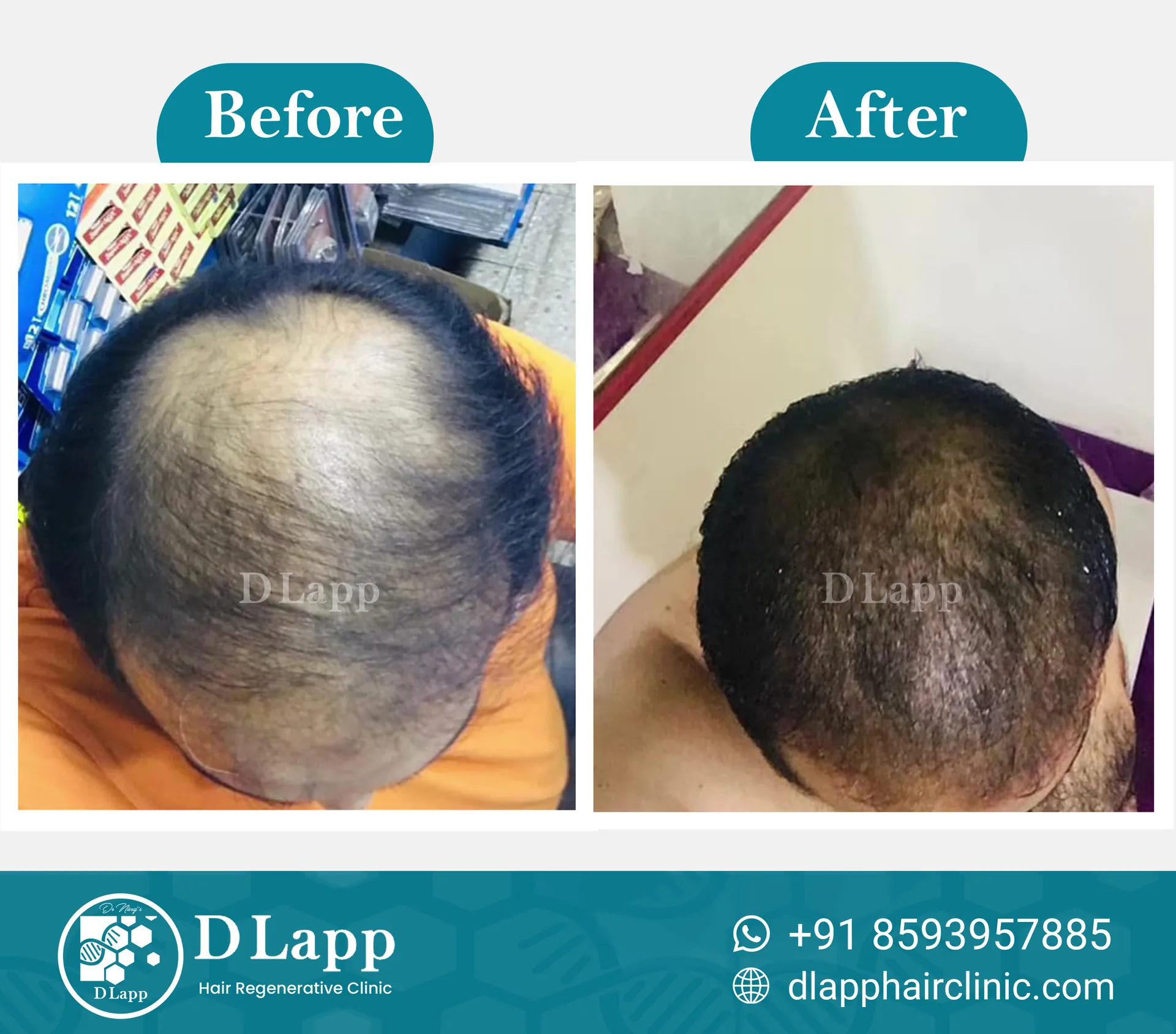 Before/After Medical Image