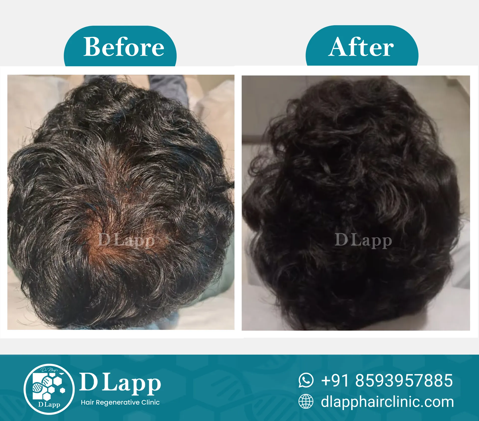 Before/After Medical Image