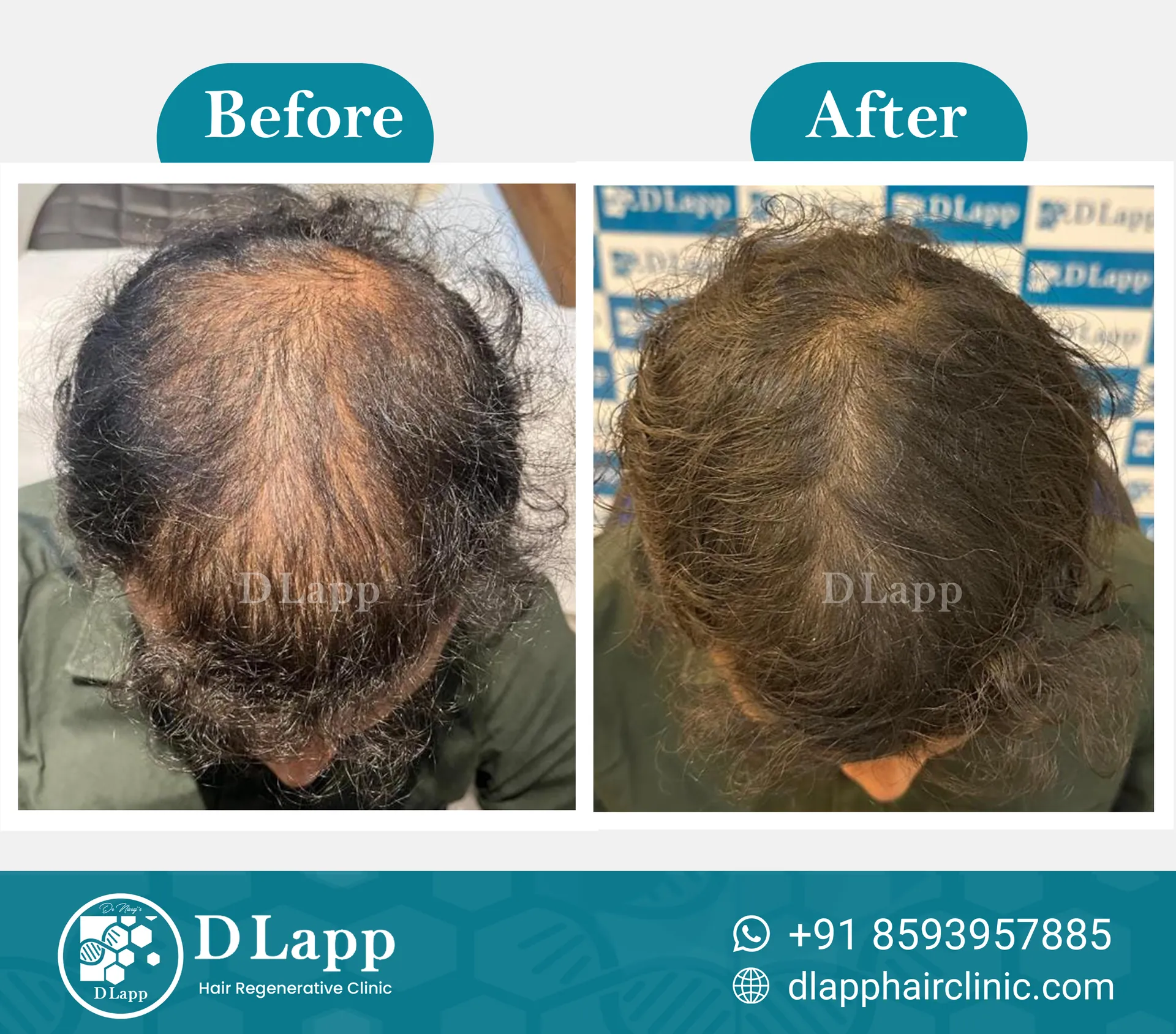 Before/After Medical Image