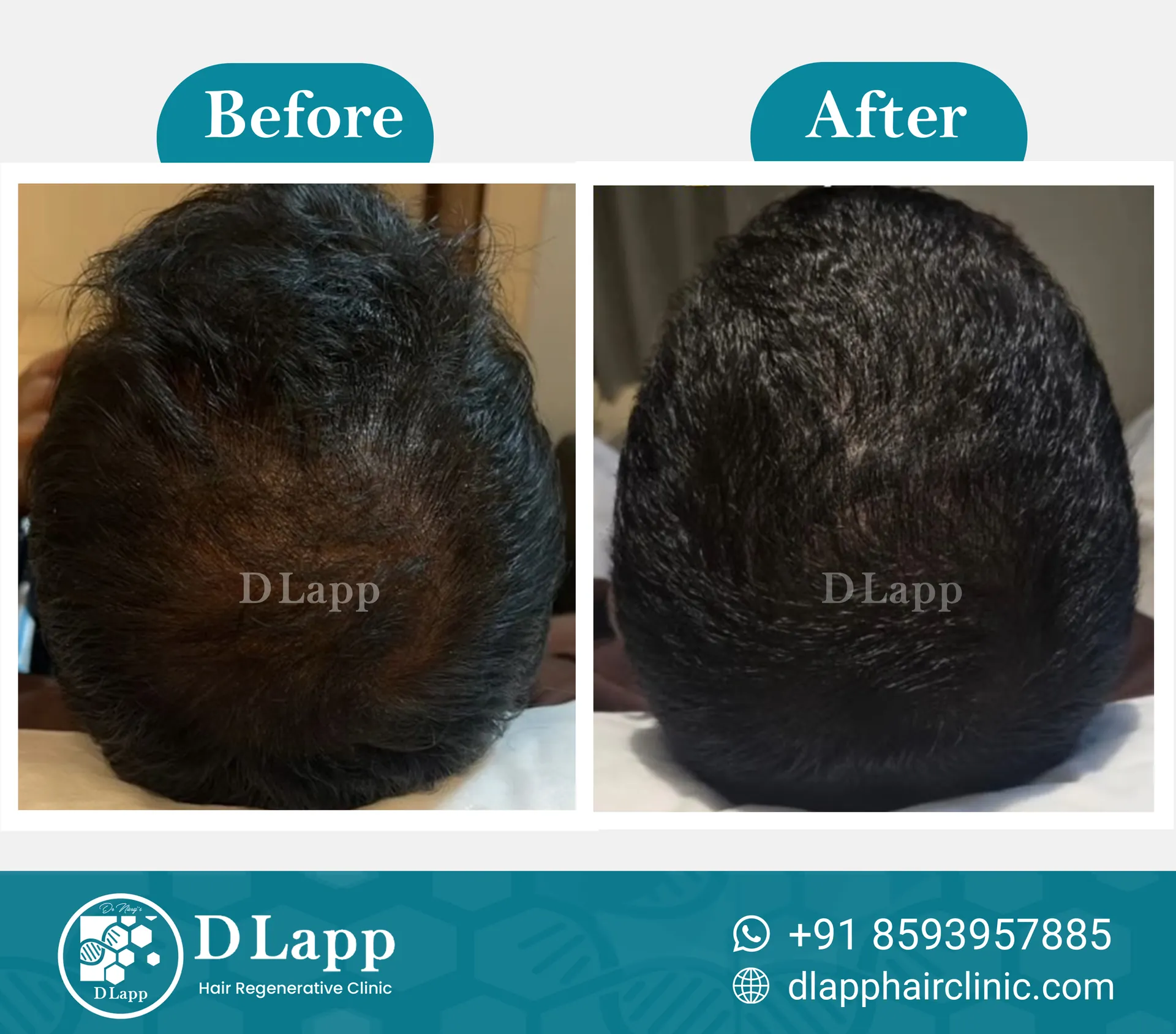 Before/After Medical Image