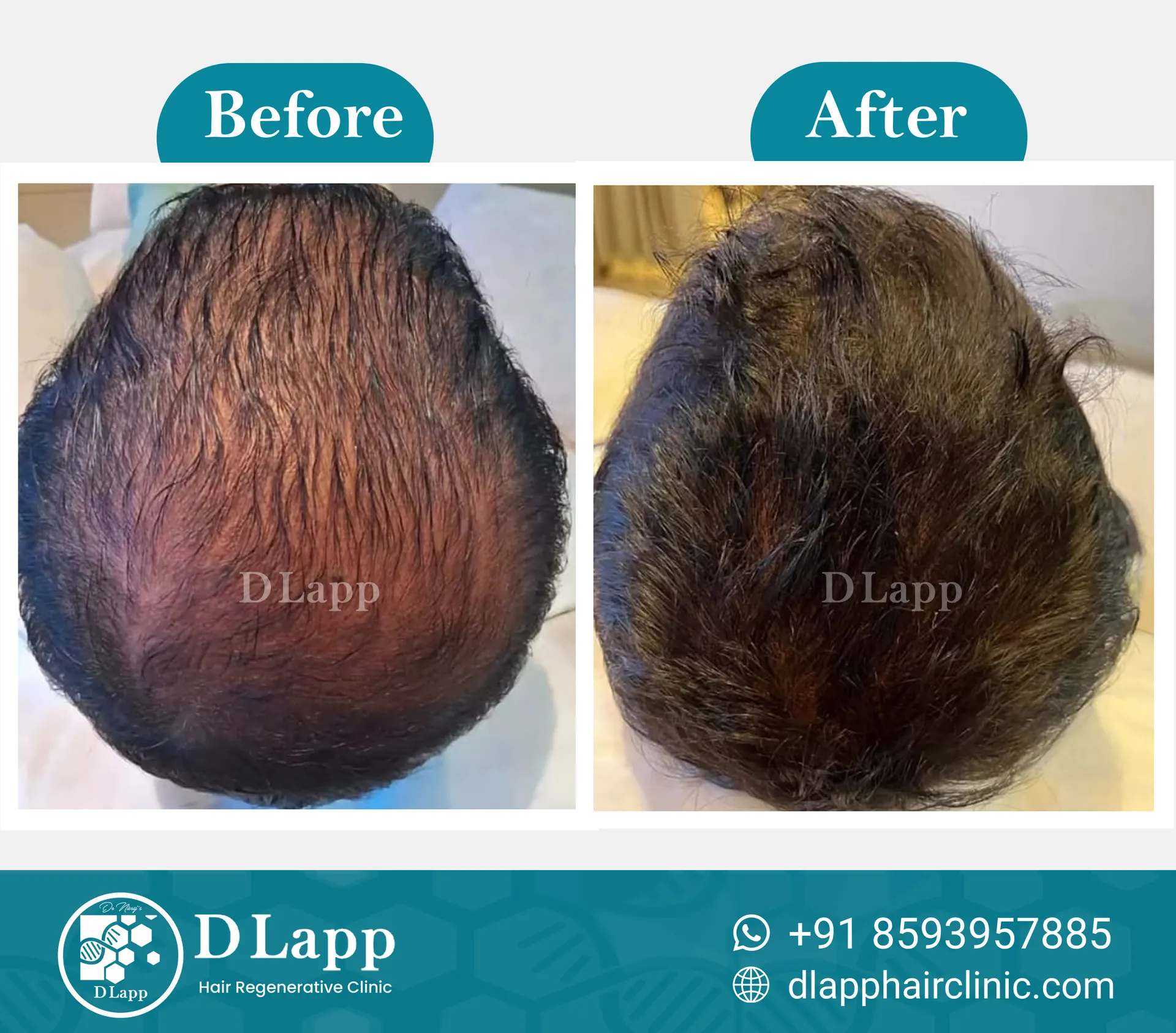Before/After Medical Image