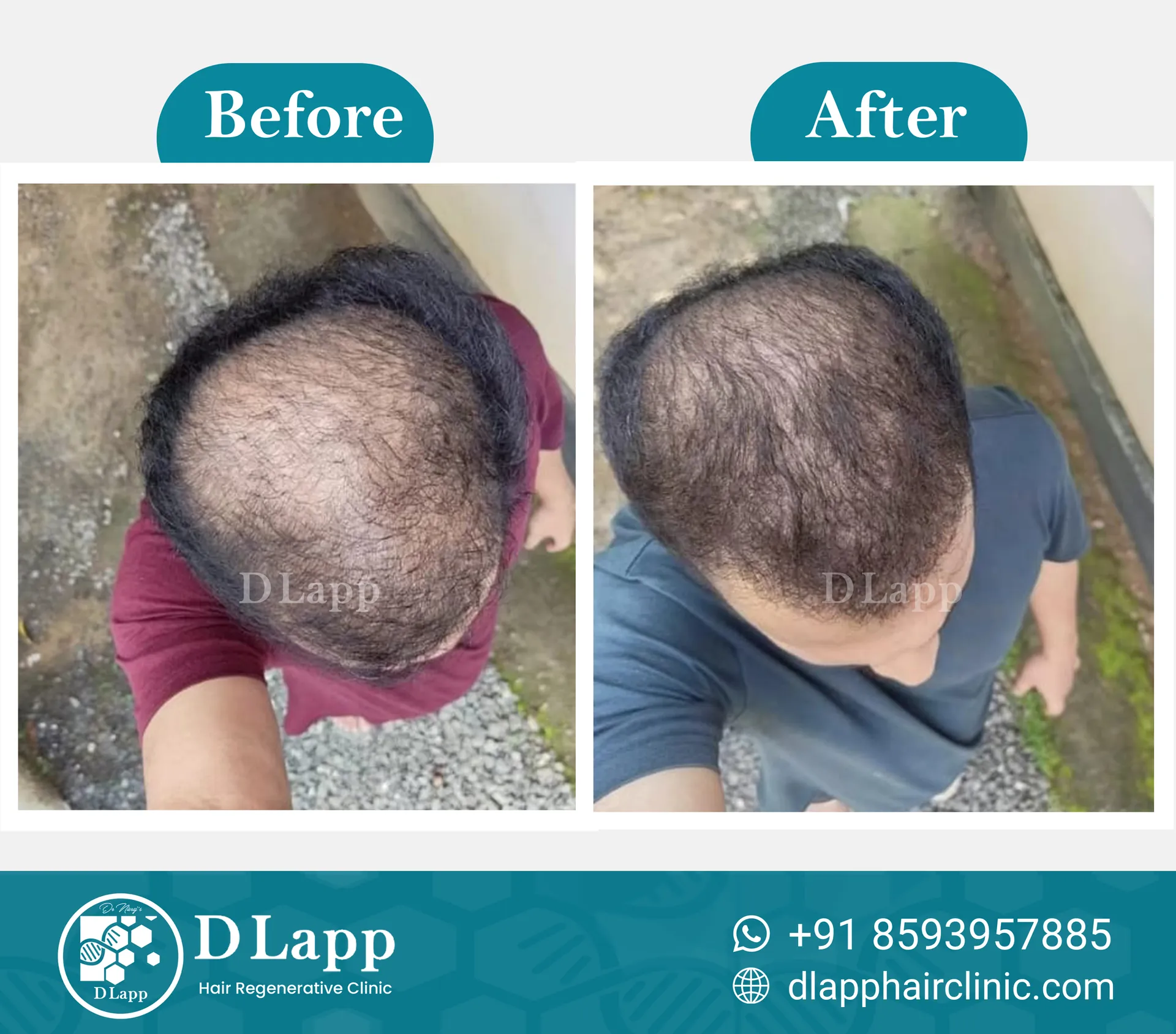 Before/After Medical Image