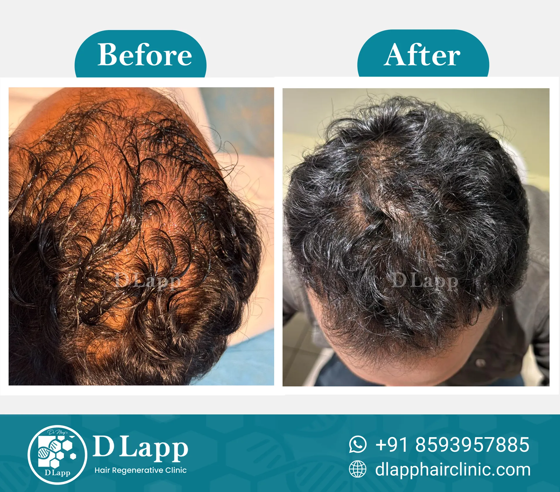 Before/After Medical Image