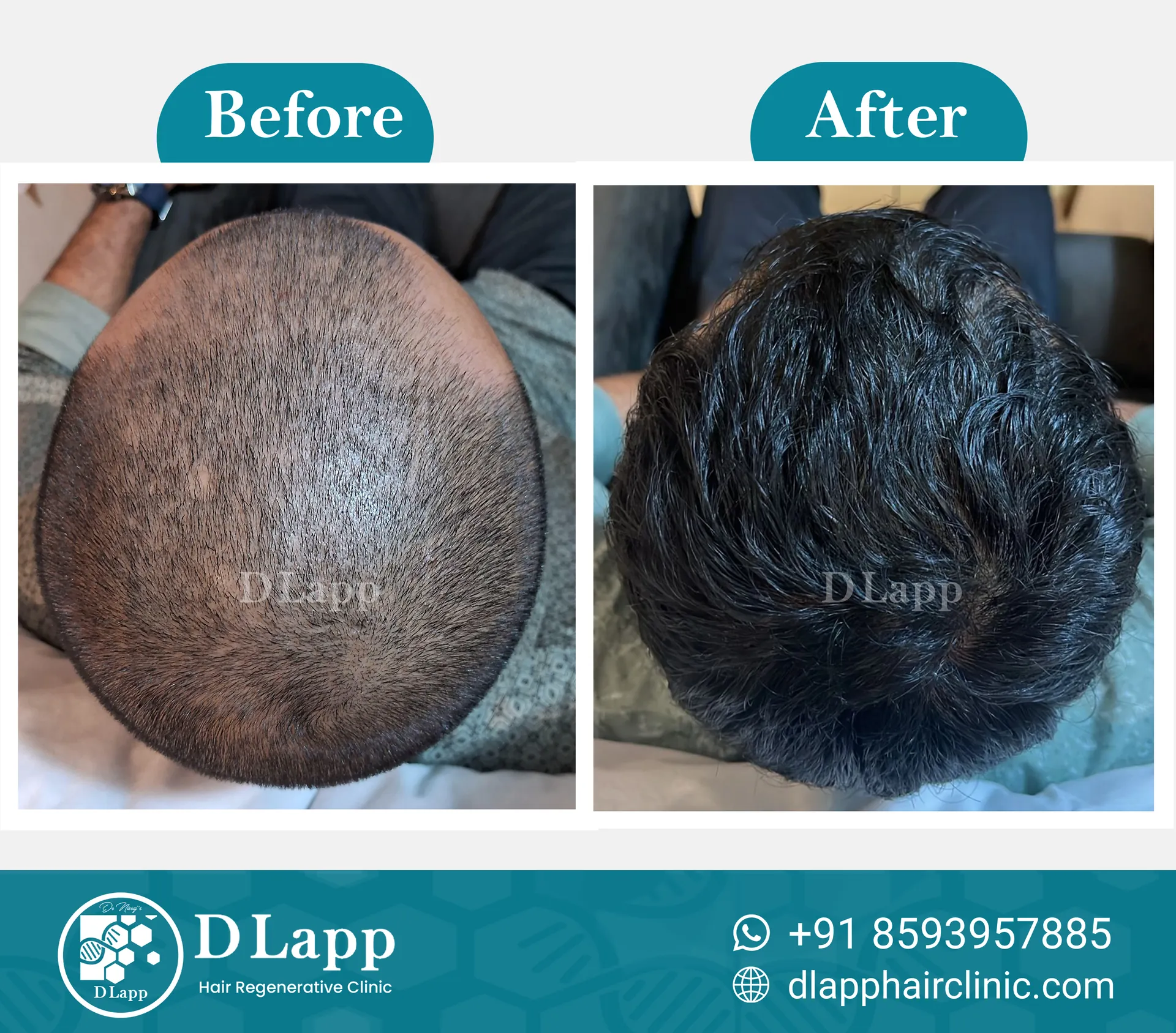 Before/After Medical Image