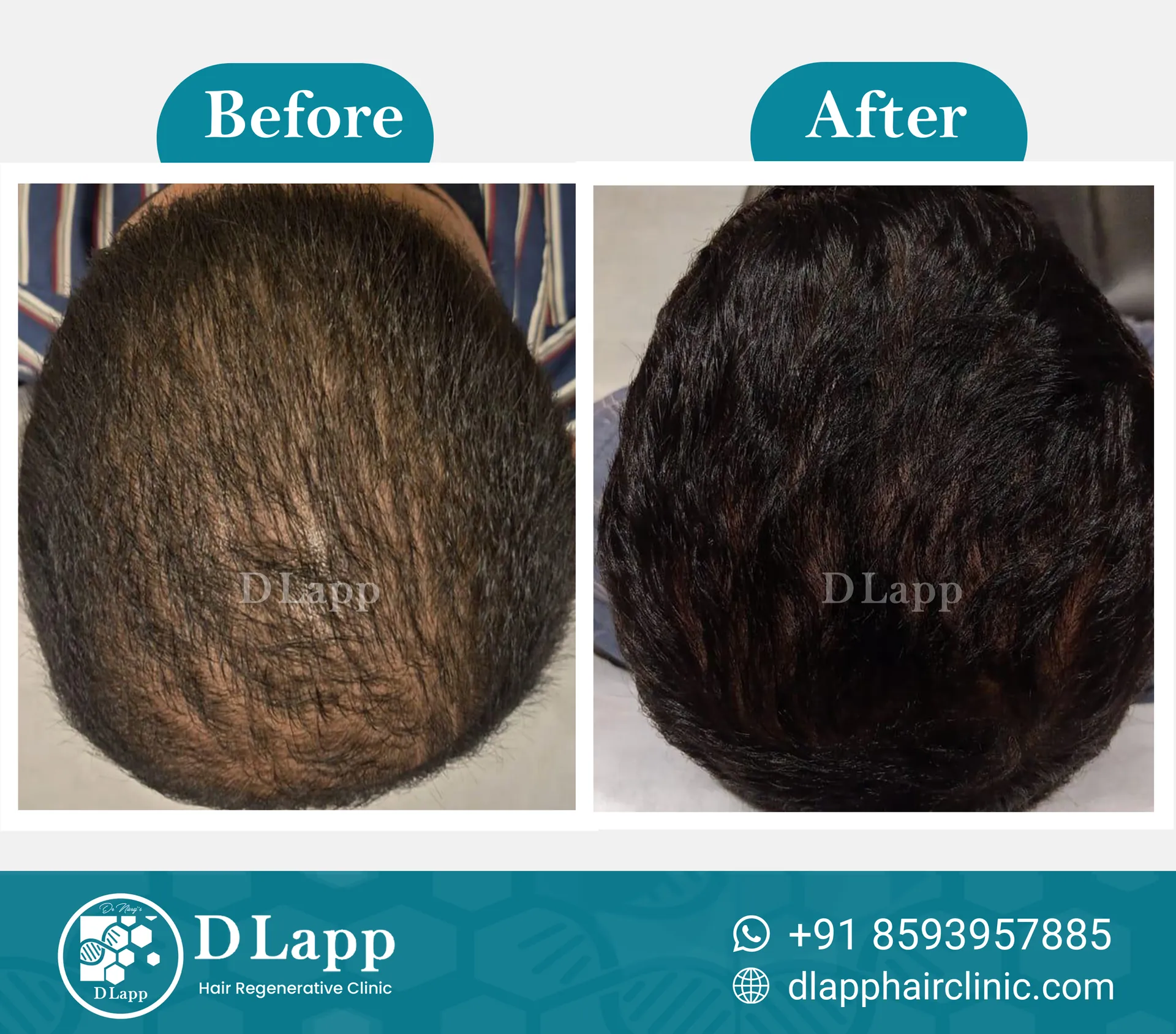 Before/After Medical Image