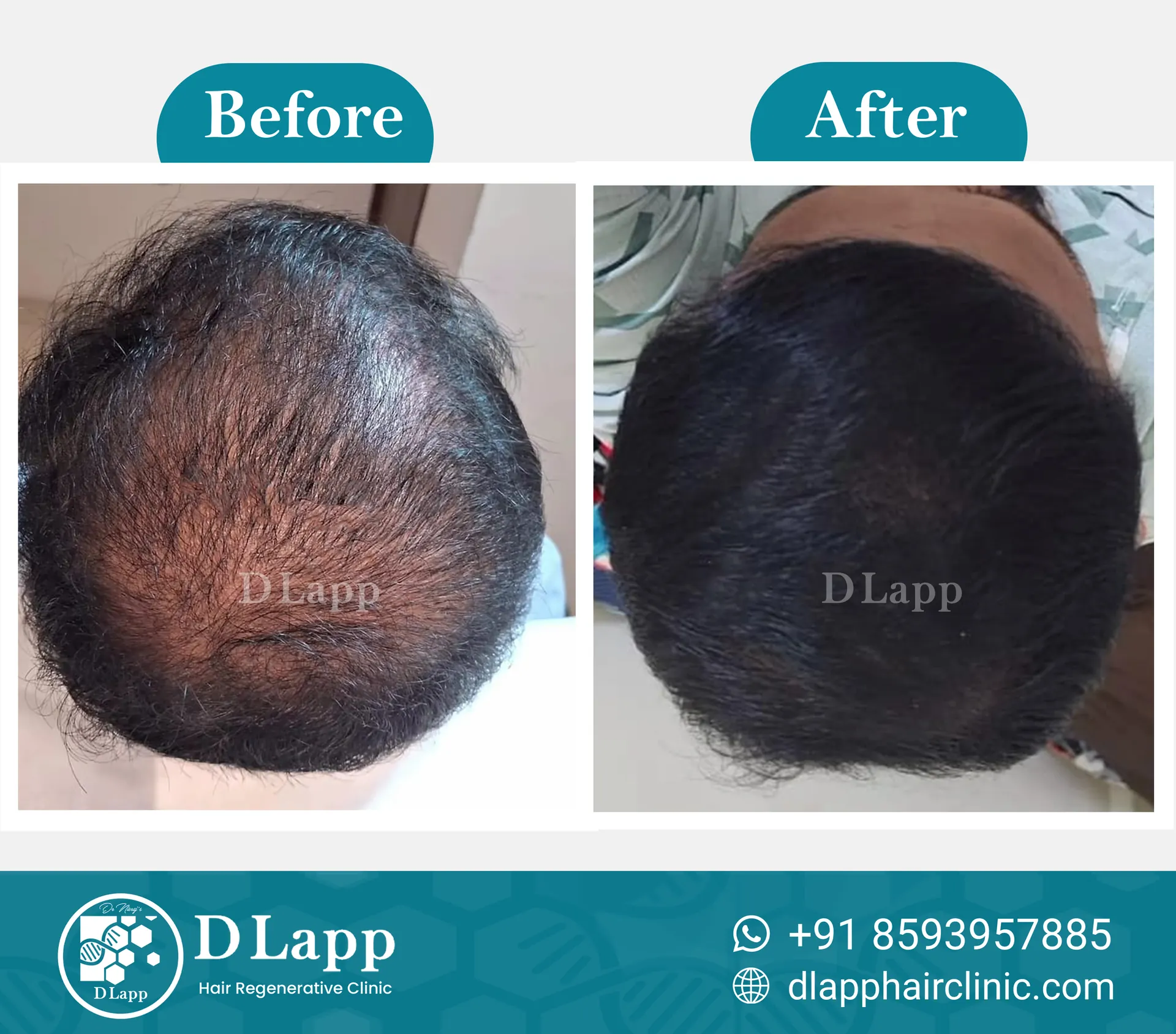 Before/After Medical Image